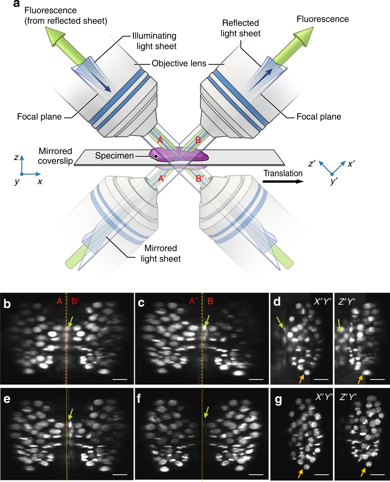 global band Whimsical Reflective imaging improves spatiotemporal resolution and collection  efficiency in light sheet microscopy | Nature Communications