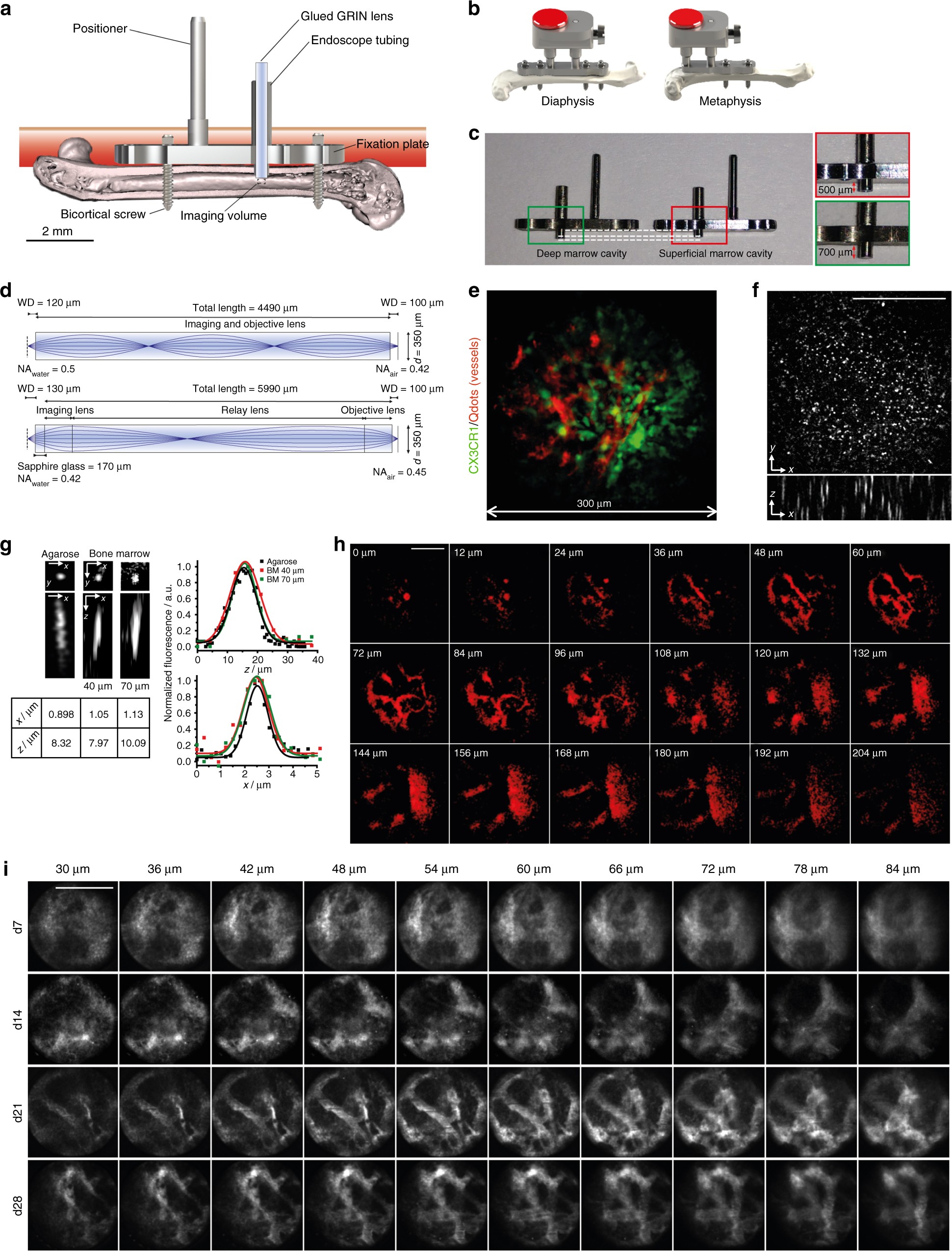 Minimally invasive longitudinal intravital imaging of cellular dynamics in  intact long bone