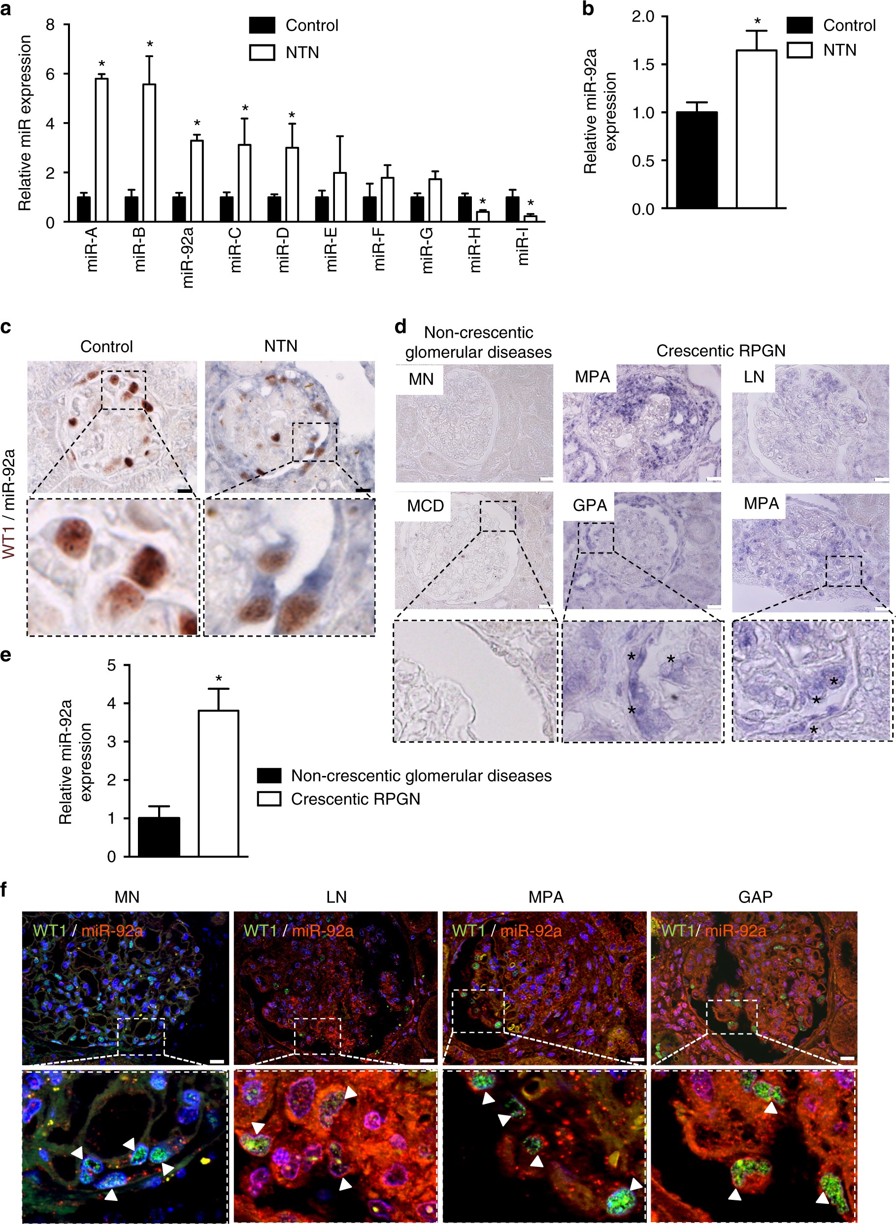 Genetic And Pharmacological Inhibition Of Microrna 92a - 