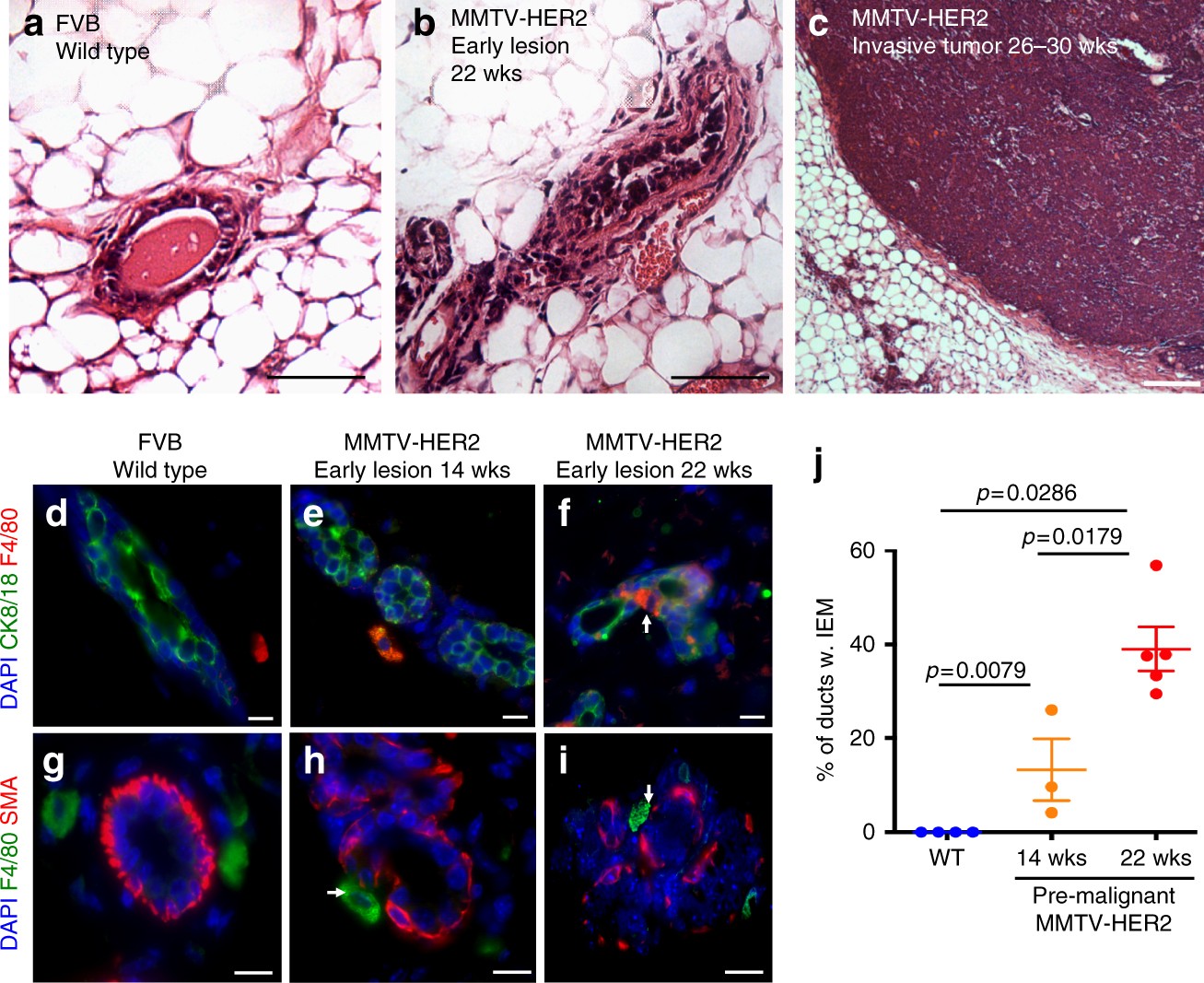 Does microtubule motor-mediated centrosomal dyshomeostasis confer  chemoresistance in breast cancer? | Journal of Mammary Gland Biology and  Neoplasia, image size:1307x1067