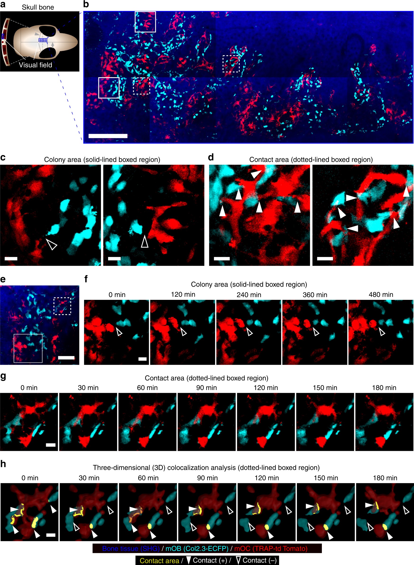 Minimally invasive longitudinal intravital imaging of cellular dynamics in  intact long bone