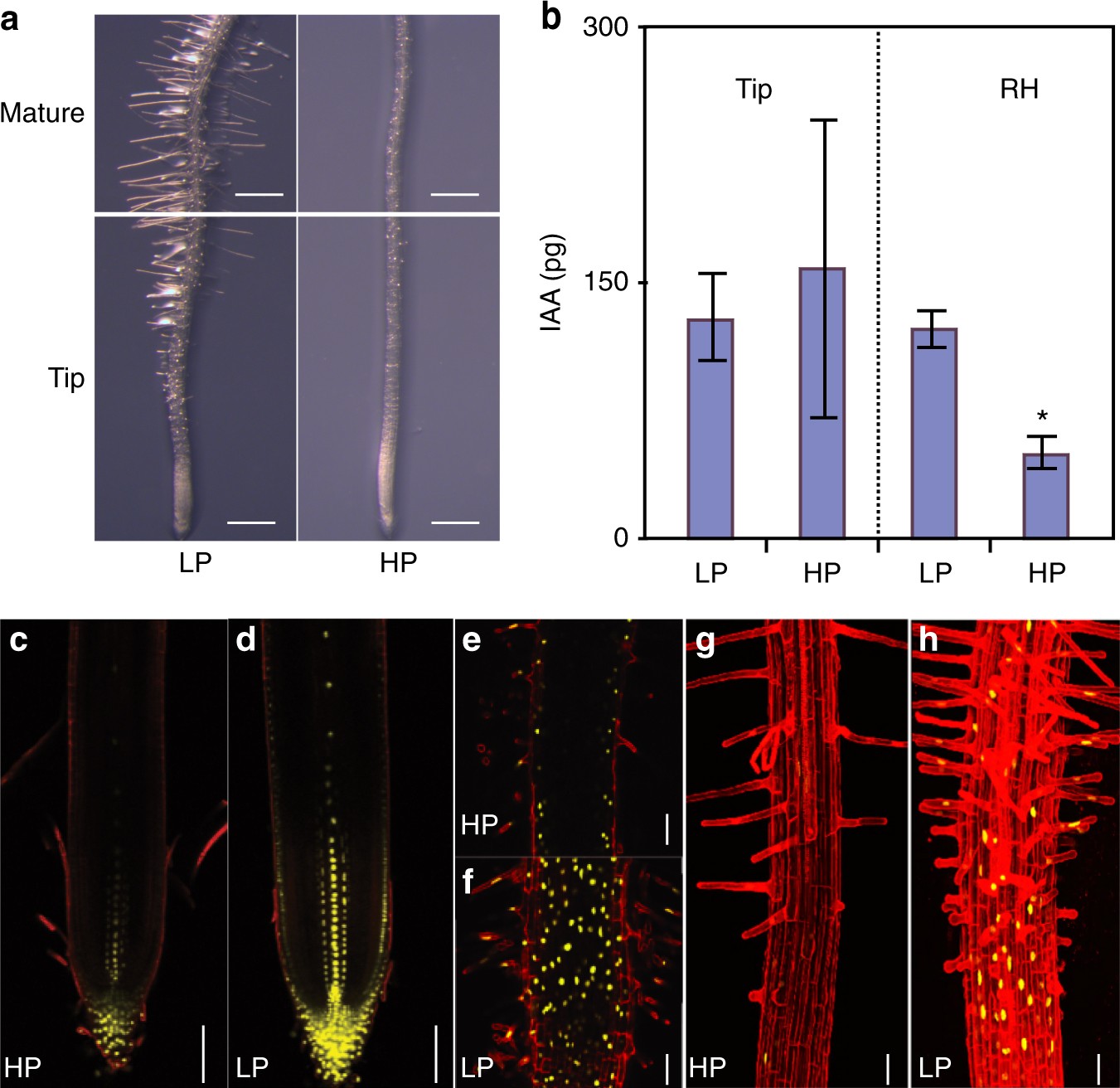 A mechanistic framework for auxin dependent Arabidopsis root hair elongation to low external phosphate | Nature Communications A mechanistic framework for auxin dependent Arabidopsis root hair elongation to low external phosphate | Nature Communications