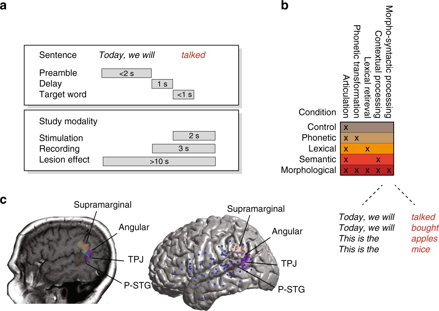 Neural Encoding And Production Of Functional Morphemes In The Posterior Temporal Lobe Nature Communications