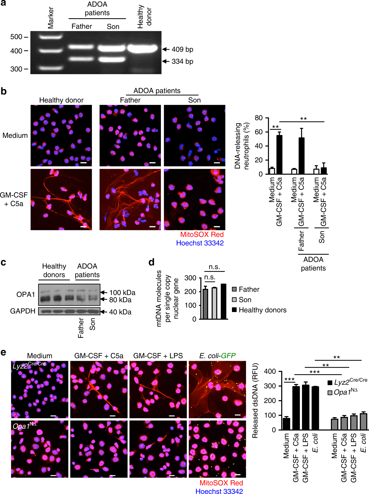 Neutrophil Extracellular Trap Formation Requires Opa1 Dependent Glycolytic Atp Production Nature Communications