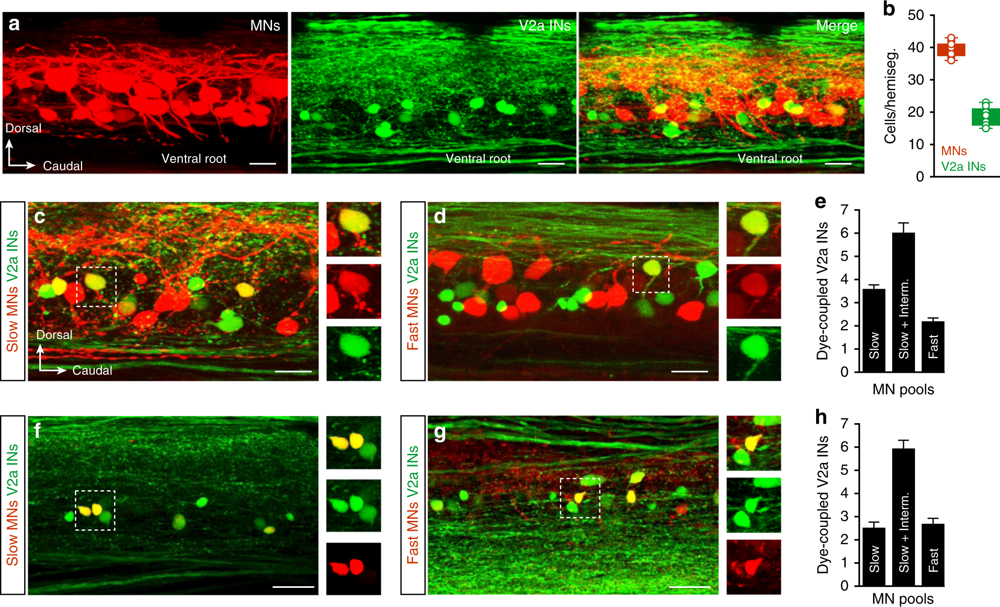 V2a interneuron diversity tailors spinal circuit organization to control  the vigor of locomotor movements | Nature Communications