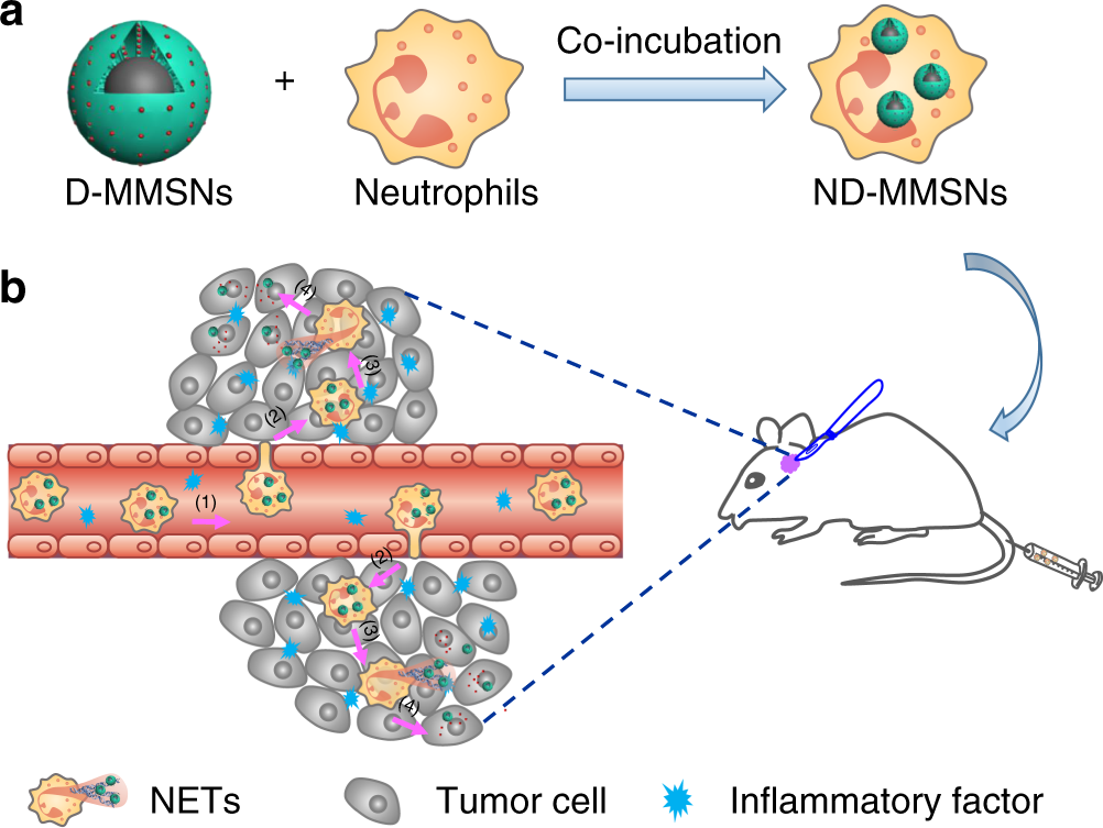 MR imaging tracking of inflammation-activatable engineered neutrophils for  targeted therapy of surgically treated glioma | Nature Communications