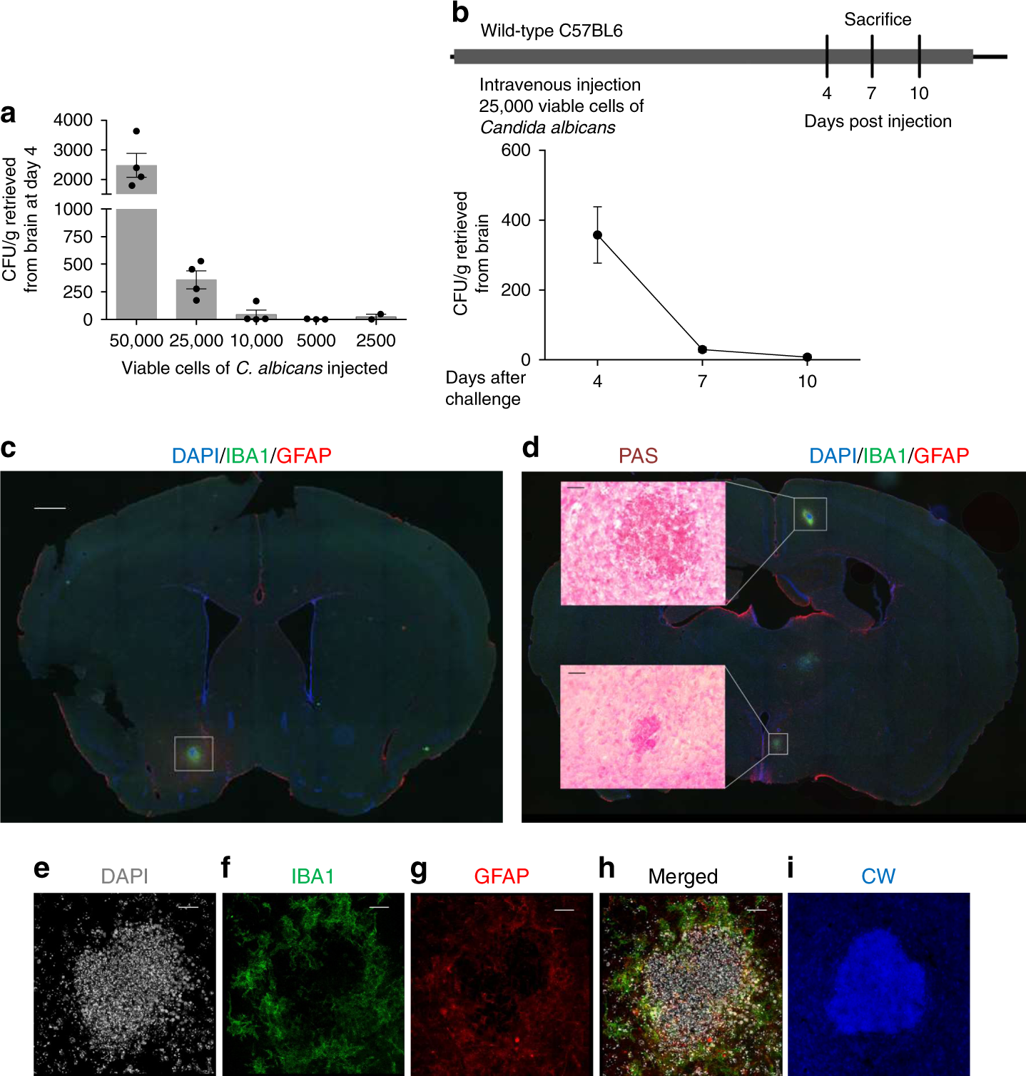 Microglia and amyloid precursor protein coordinate control of transient  Candida cerebritis with memory deficits | Nature Communications