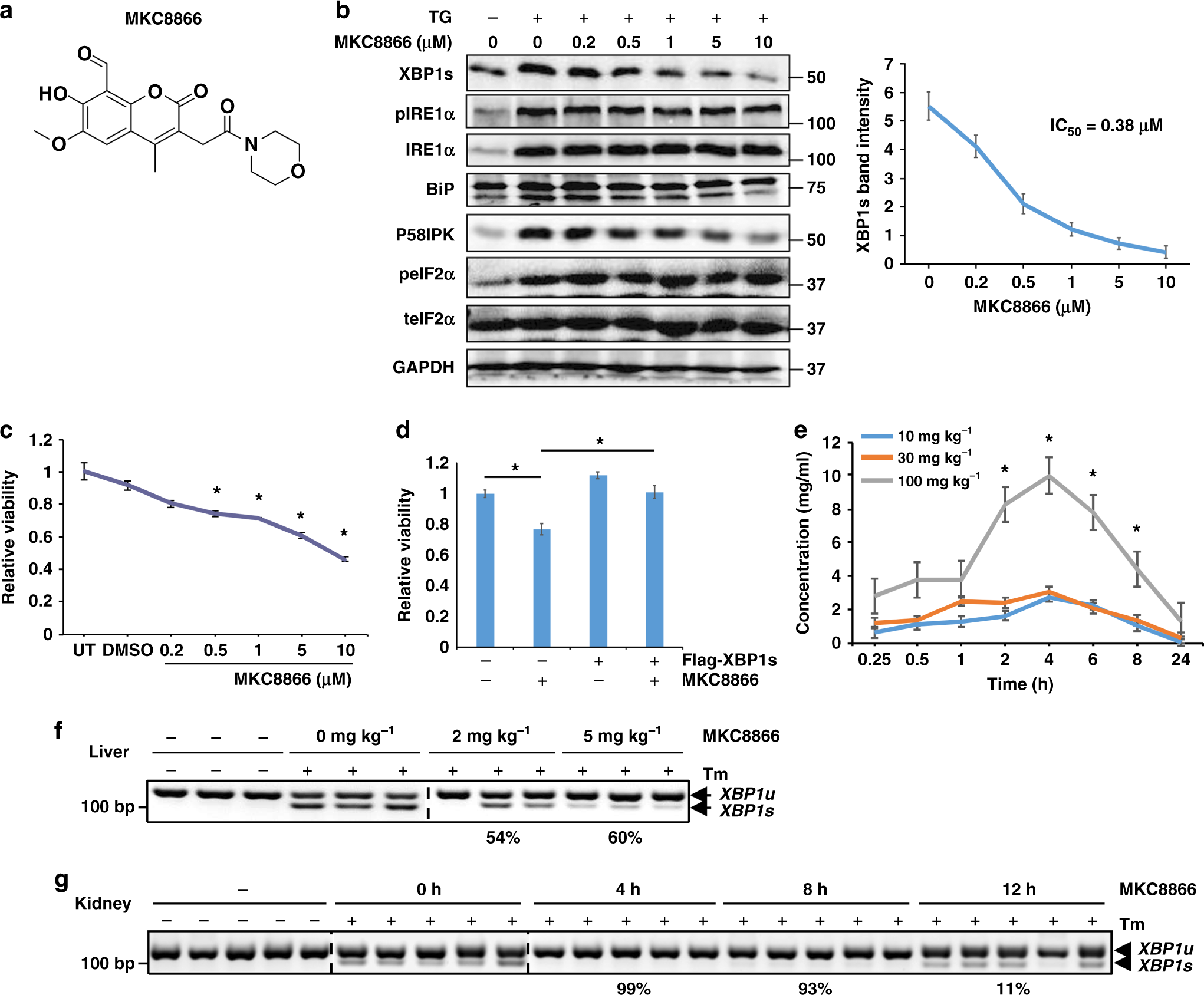 IRE1α-XBP1s pathway promotes prostate cancer by activating c-MYC signaling  | Nature Communications