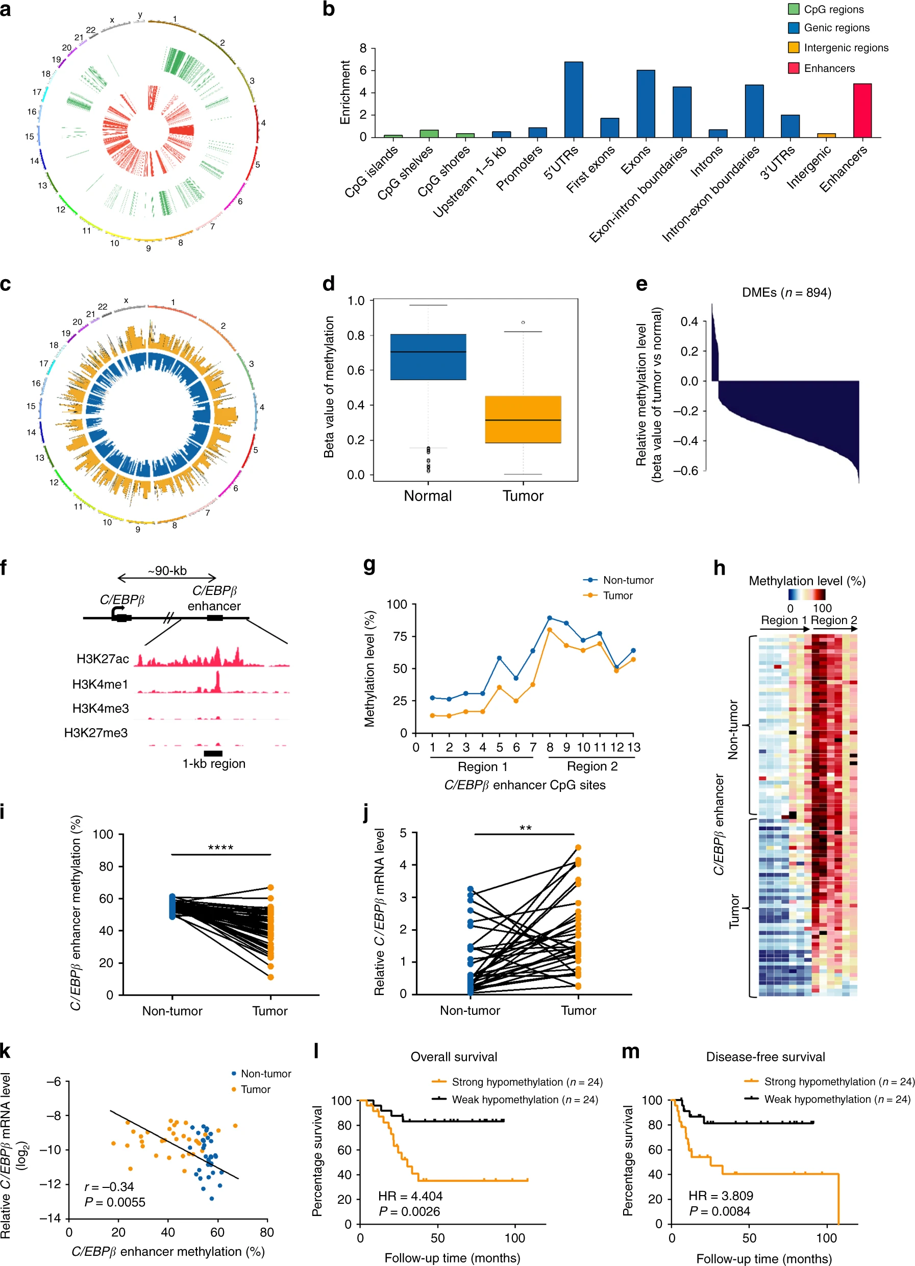 Aberrant enhancer hypomethylation contributes to hepatic carcinogenesis through global transcriptional reprogramming