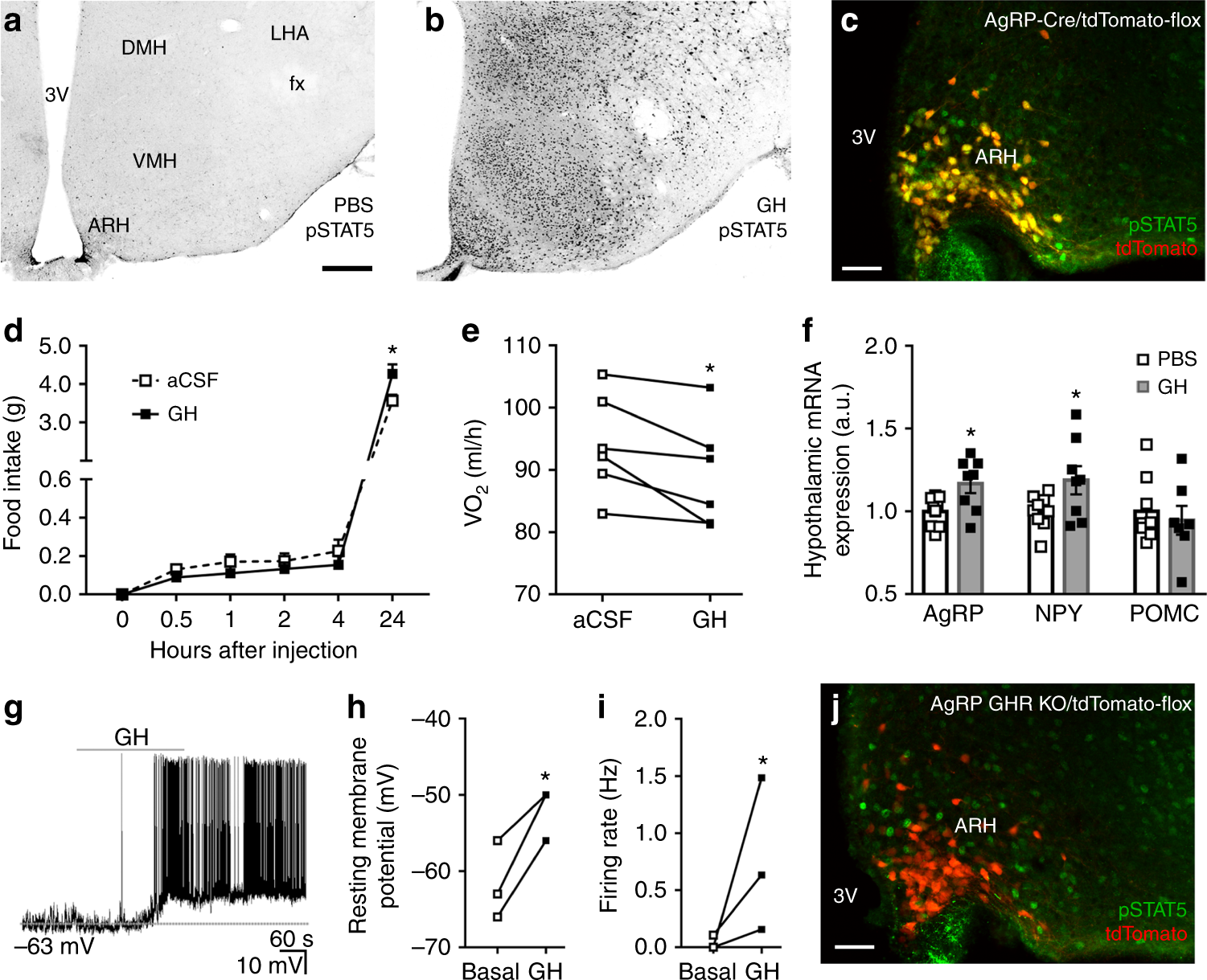 Growth Hormone Regulates Neuroendocrine Responses To Weight Loss