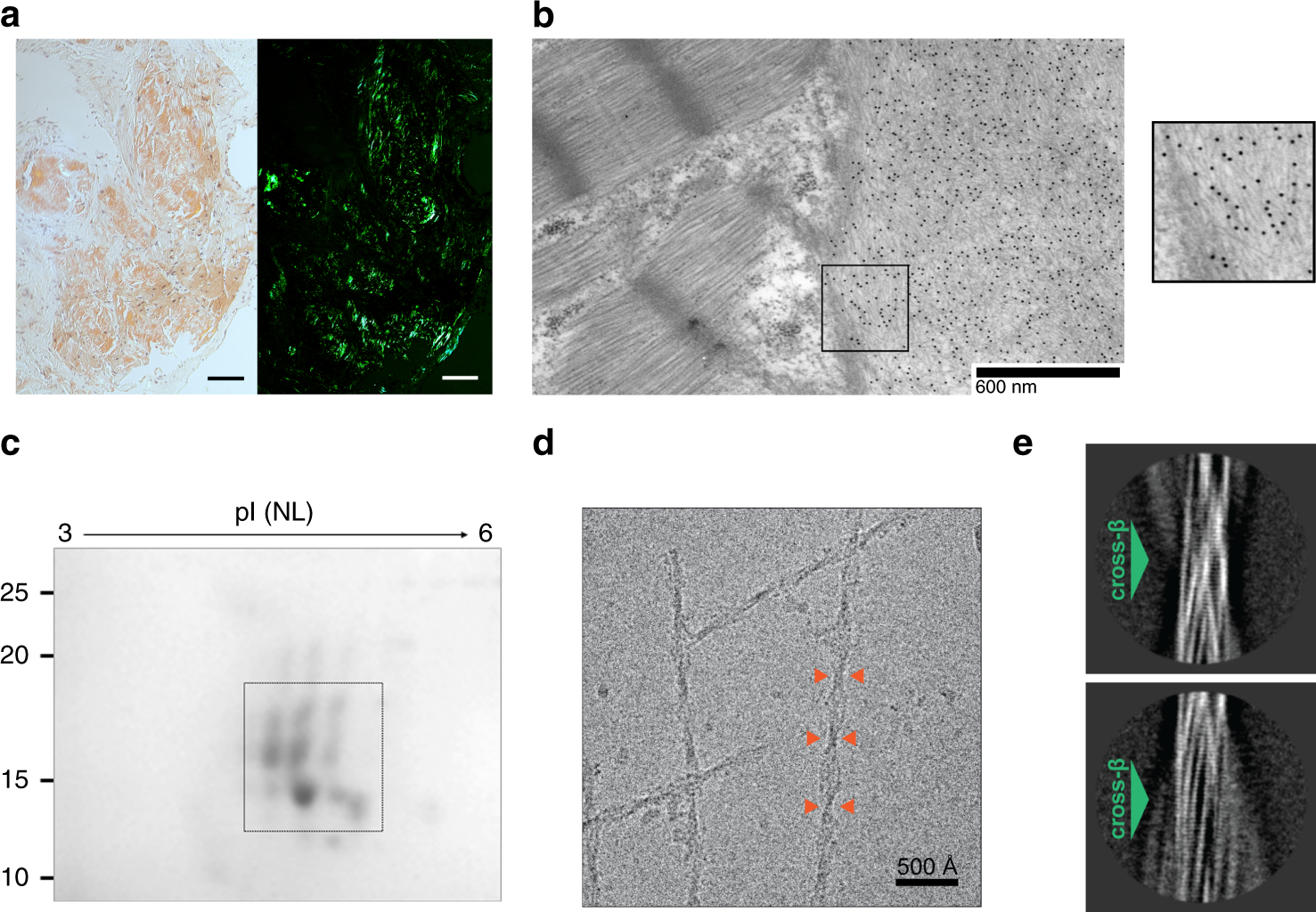 of cardiac fibrils Cryo-EM from structure amyloid an ...