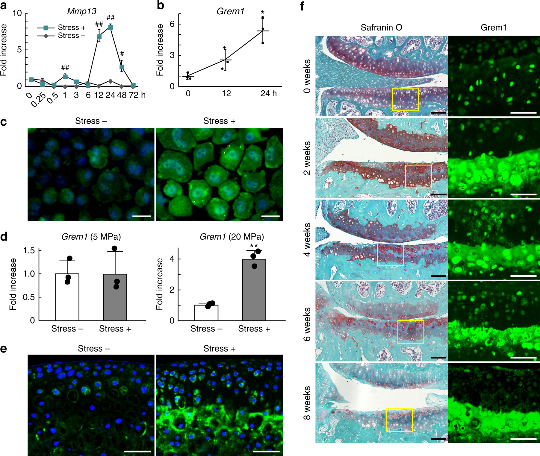 PDF) Excessive mechanical loading promotes osteoarthritis through