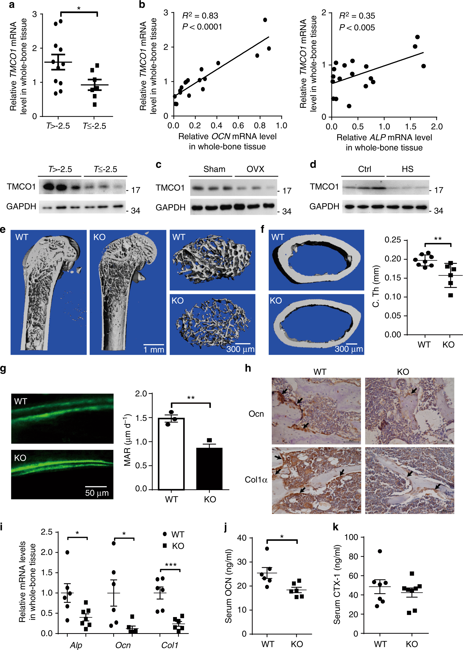 Tmco1 Mediated Ca2 Leak Underlies Osteoblast Functions Via Camkii Signaling Nature Communications