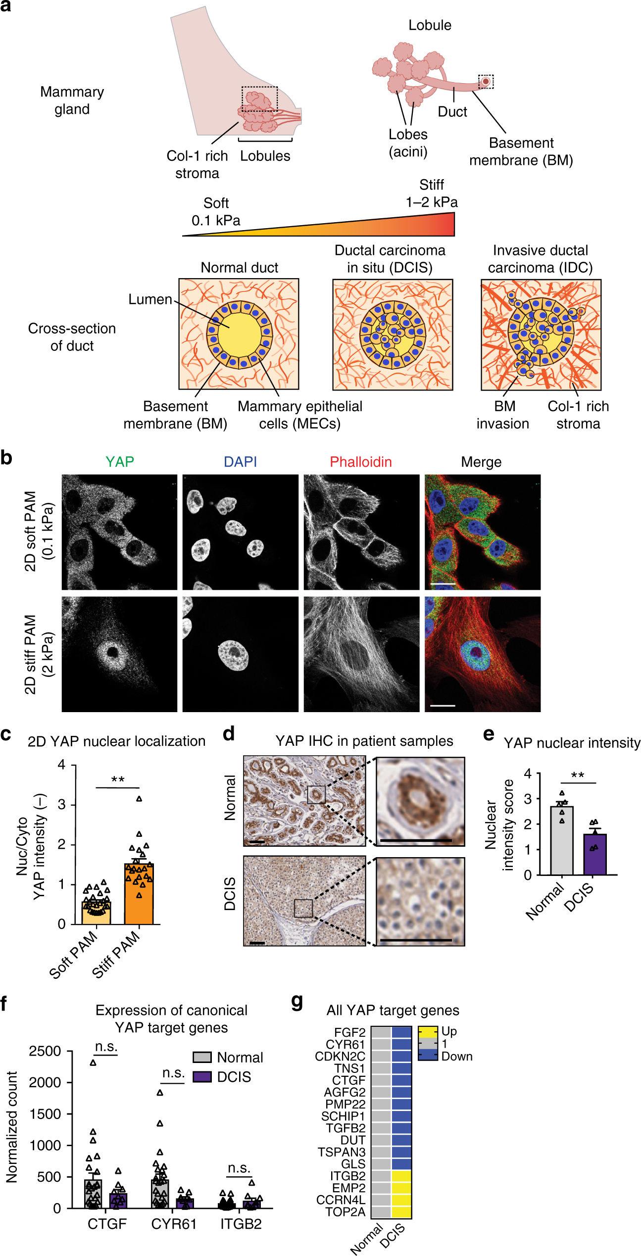YAP-independent mechanotransduction drives breast cancer progression |  Nature Communications