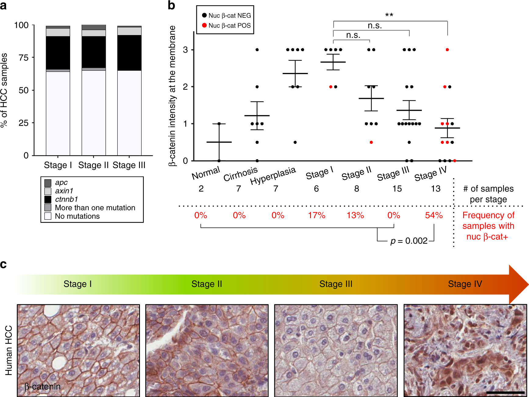 Promotion Of Growth Factor Signaling As A Critical Function Of B Catenin During Hcc Progression Nature Communications Promotion Of Growth Factor Signaling As A Critical Function Of B Catenin During Hcc Progression Nature Communications