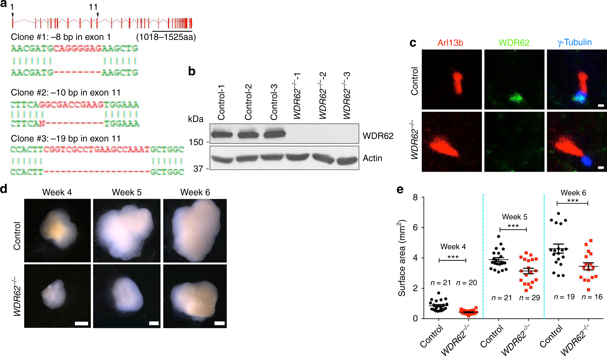 Modeling microcephaly with cerebral organoids reveals a WDR62–CEP170–KIF2A  pathway promoting cilium disassembly in neural progenitors | Nature  Communications