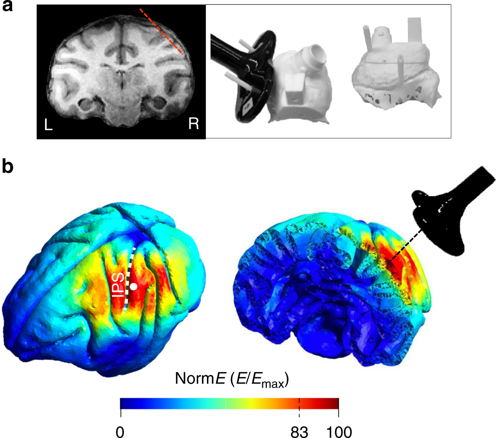 Neural effects of transcranial magnetic stimulation at the single-cell  level | Nature Communications