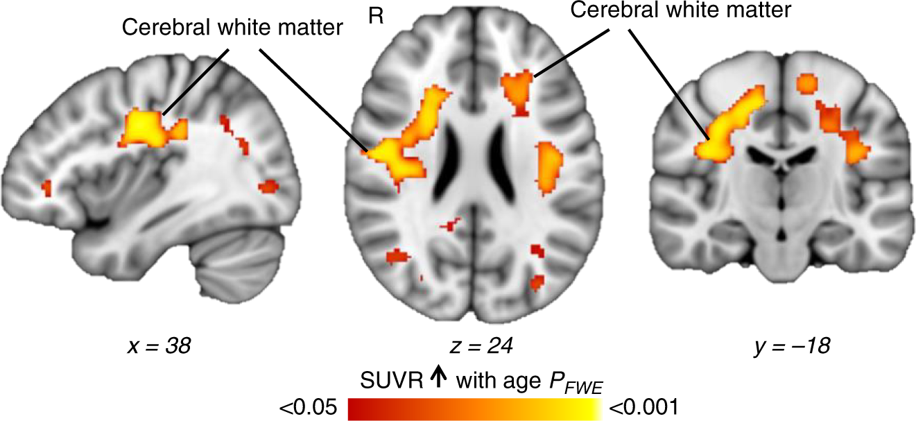 human brain mapping fsl course human brain mapping fsl course