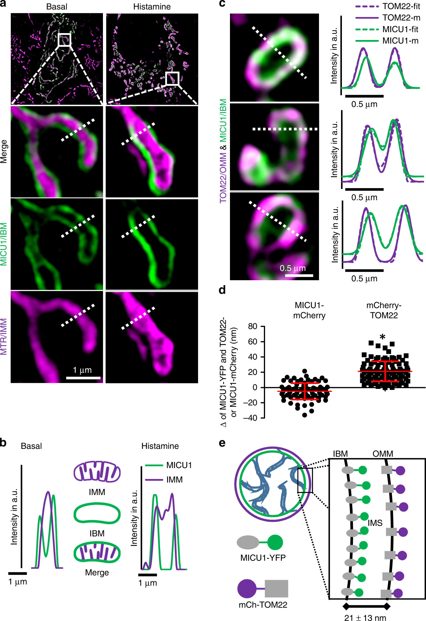 MICU1 controls cristae junction and spatially anchors mitochondrial Ca2+  uniporter complex | Nature Communications