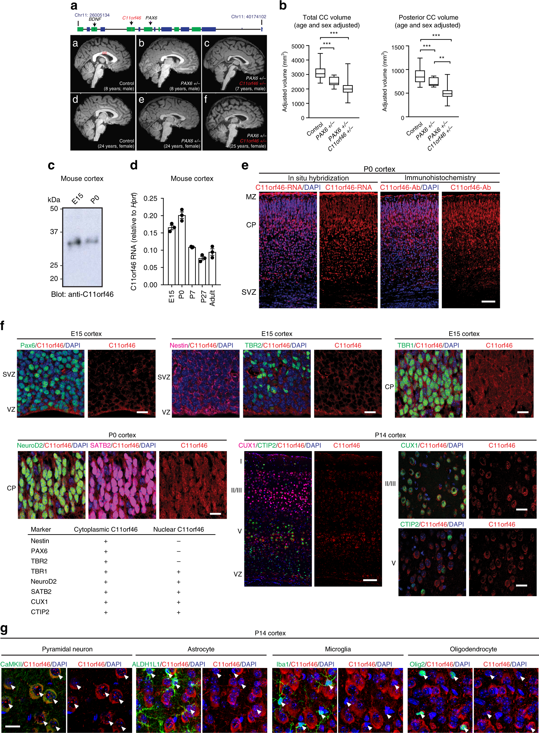 In Vivo Epigenetic Editing Of Sema6a Promoter Reverses Transcallosal Dysconnectivity Caused By C11orf46 Arl14ep Risk Gene Nature Communications