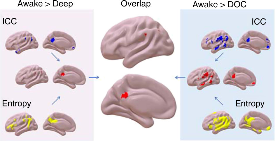 lefebvre et al human brain mapping