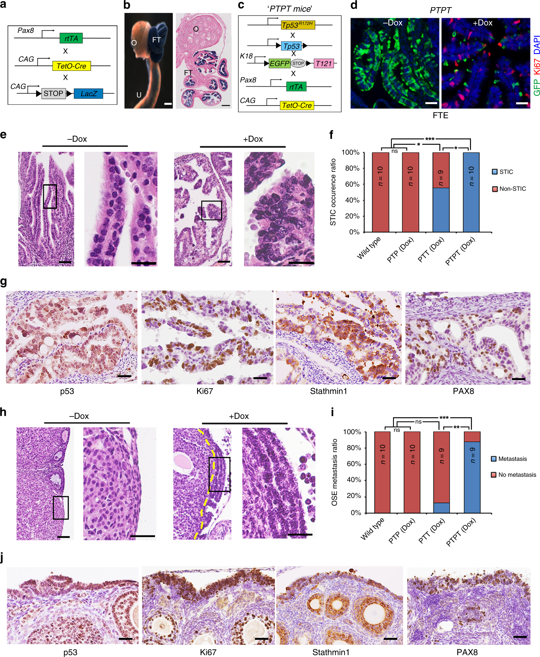 General Information About Ovarian Epithelial, Fallopian Tube, and Primary  Peritoneal Cancer