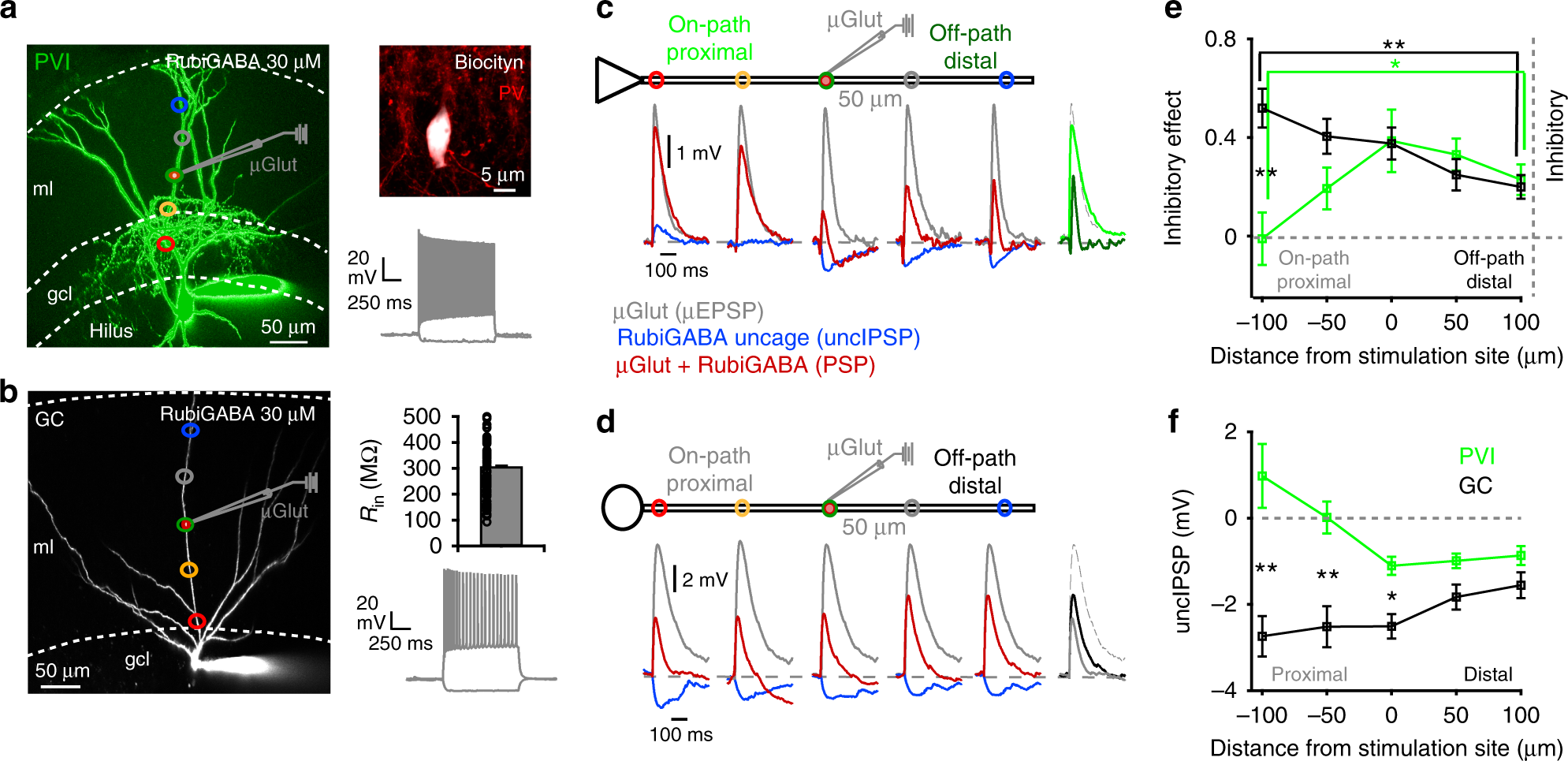 Location and distribution of inhibitory synapses differentially affect