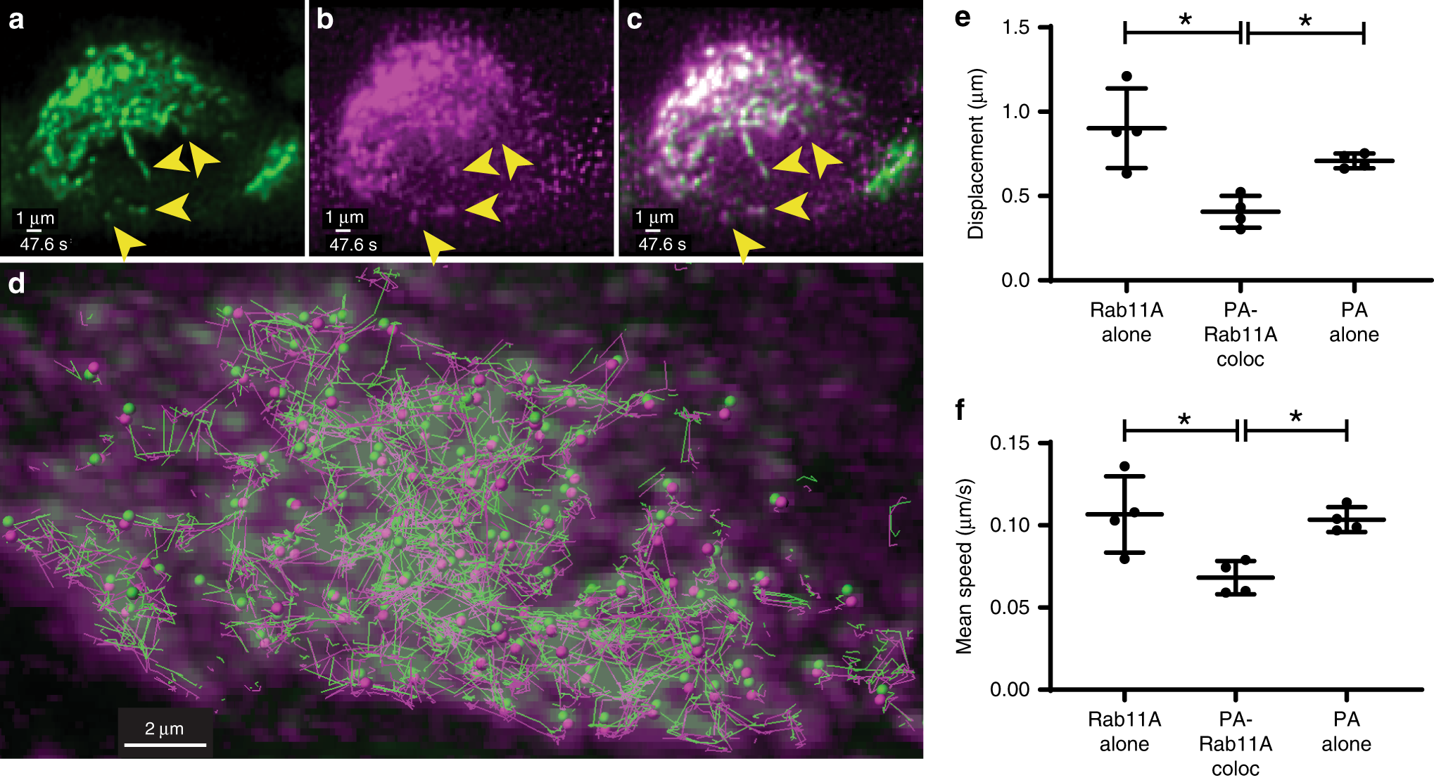 Fig. 6: Two-color imaging of PA::mRuby-infected GFP-Rab11A cells.