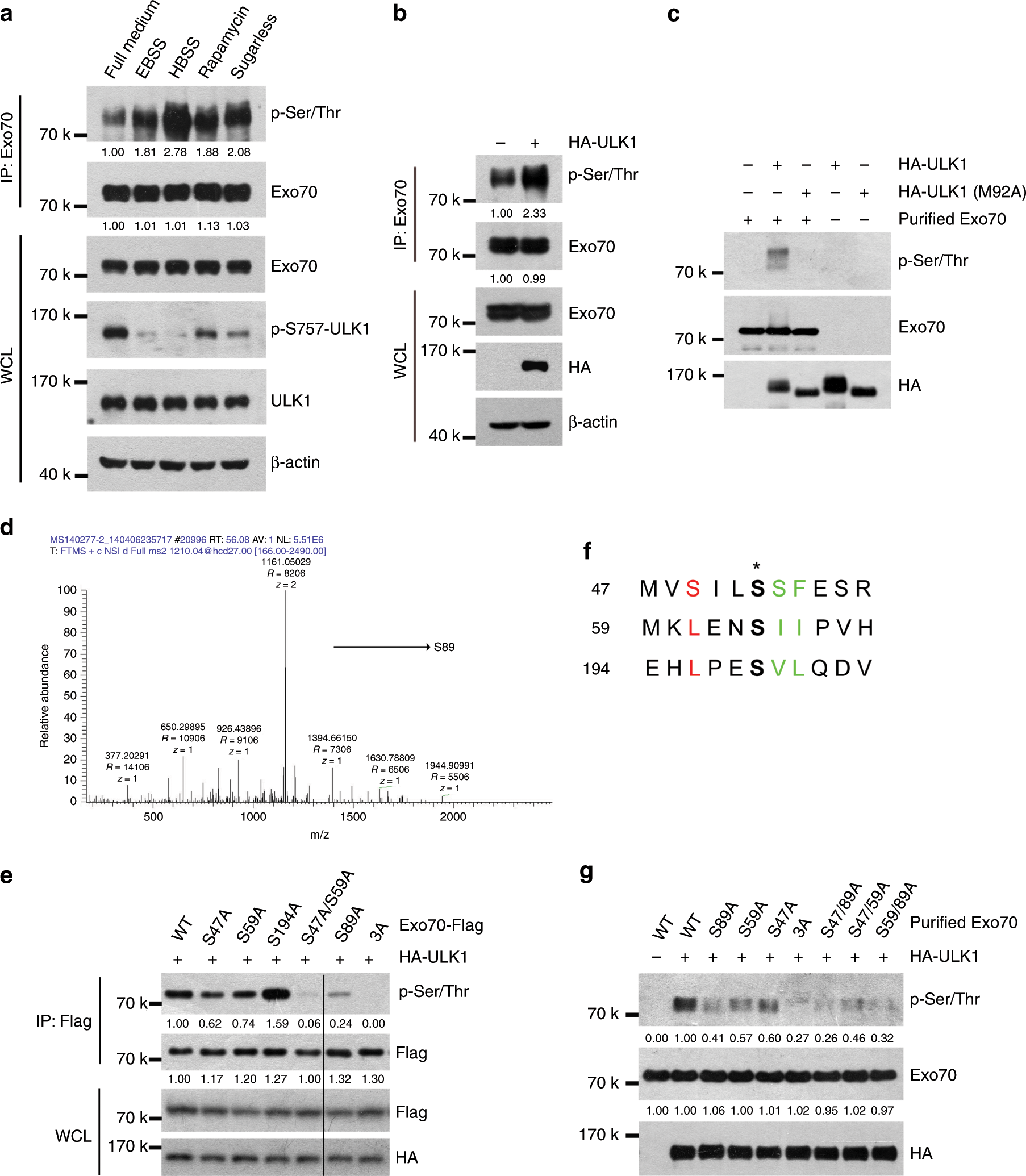Fig. 3: Exo70 is phosphorylated by ULK1 on Ser47, Ser59, and Ser89.