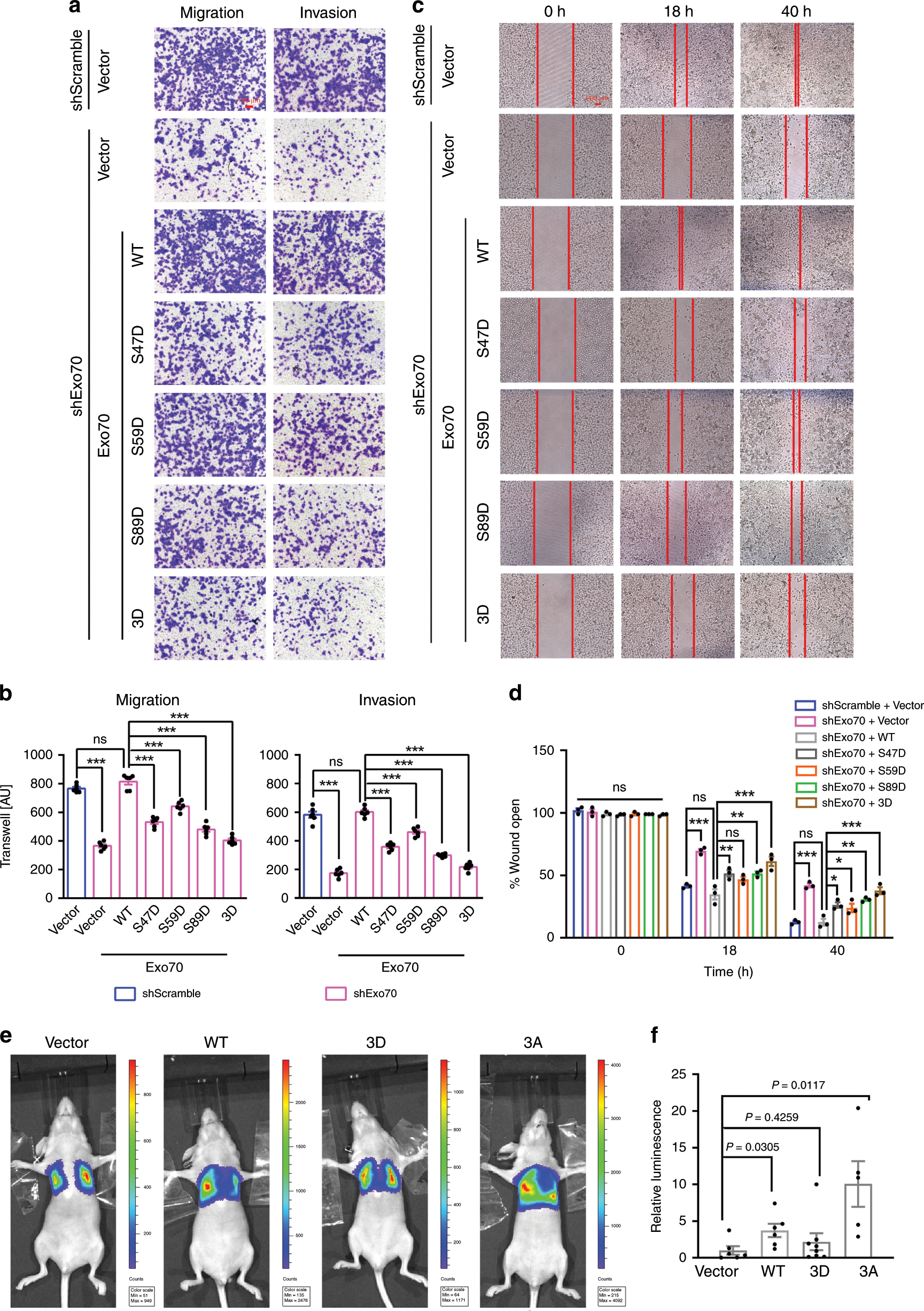 Fig. 4: Phosphorylation of Exo70 on Ser47/59/89 inhibited breast cancer metastasis.
