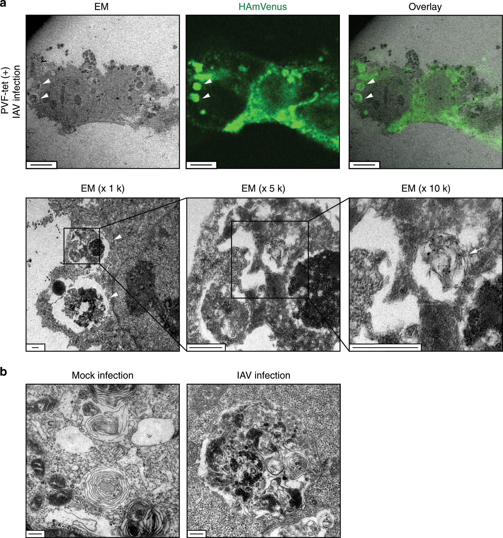Fig. 5: The HA-containing structures have not only lamellar membranous features but also electron-dense core features.