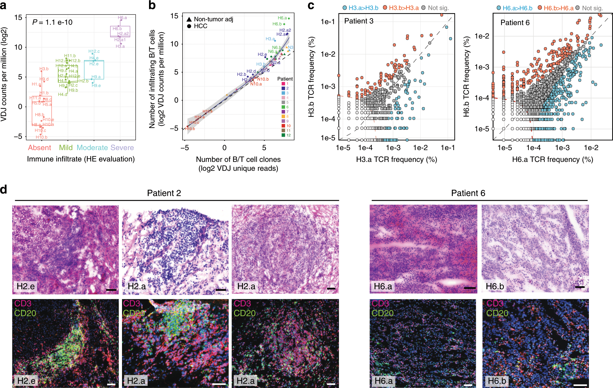 Fig. 2: Immunogenomic view of regional cancer-immune interactions in HCC and immune infiltrates.