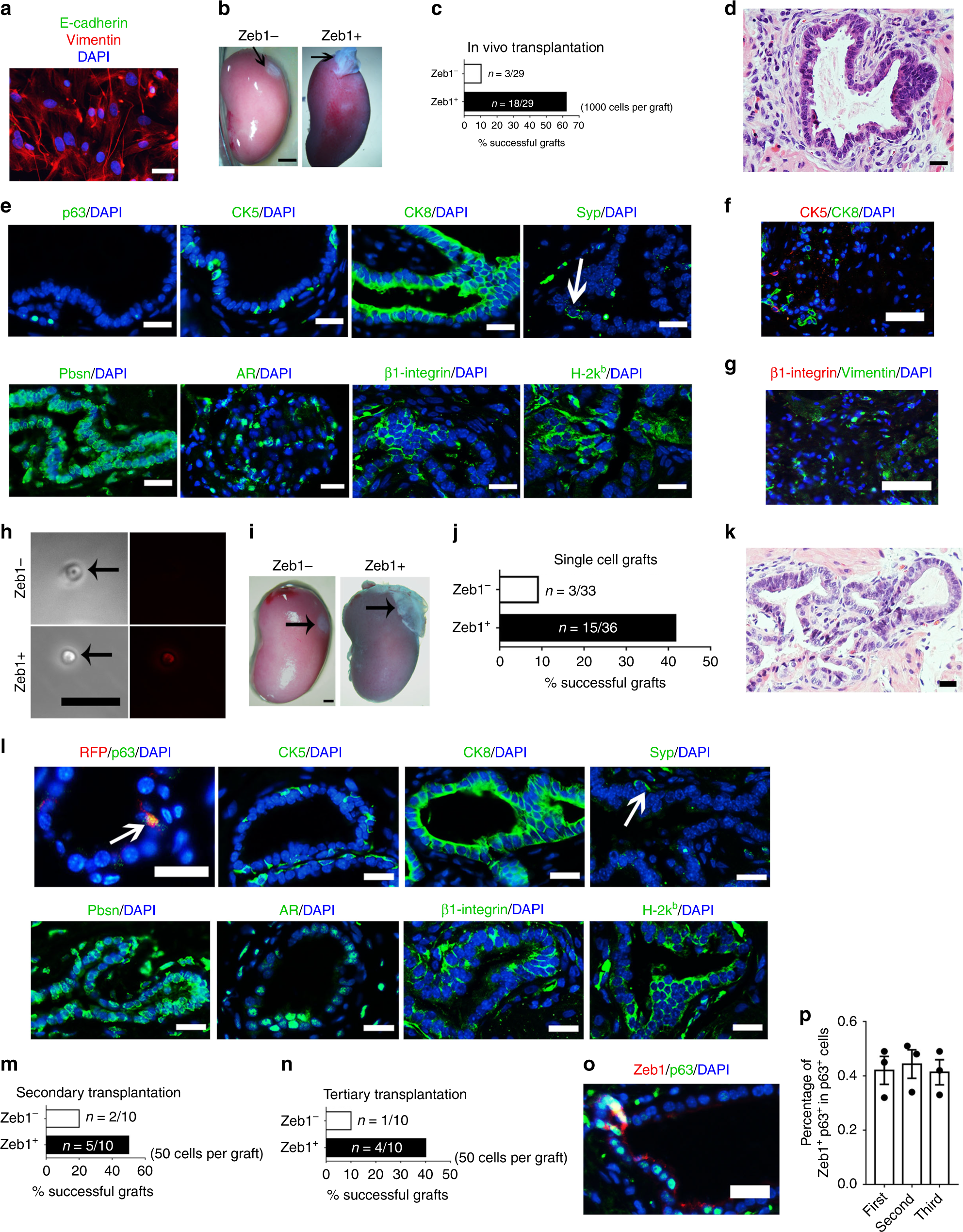 Fig. 3: LSCZeb1+ cells can self-renew and generate functional prostate in vivo.