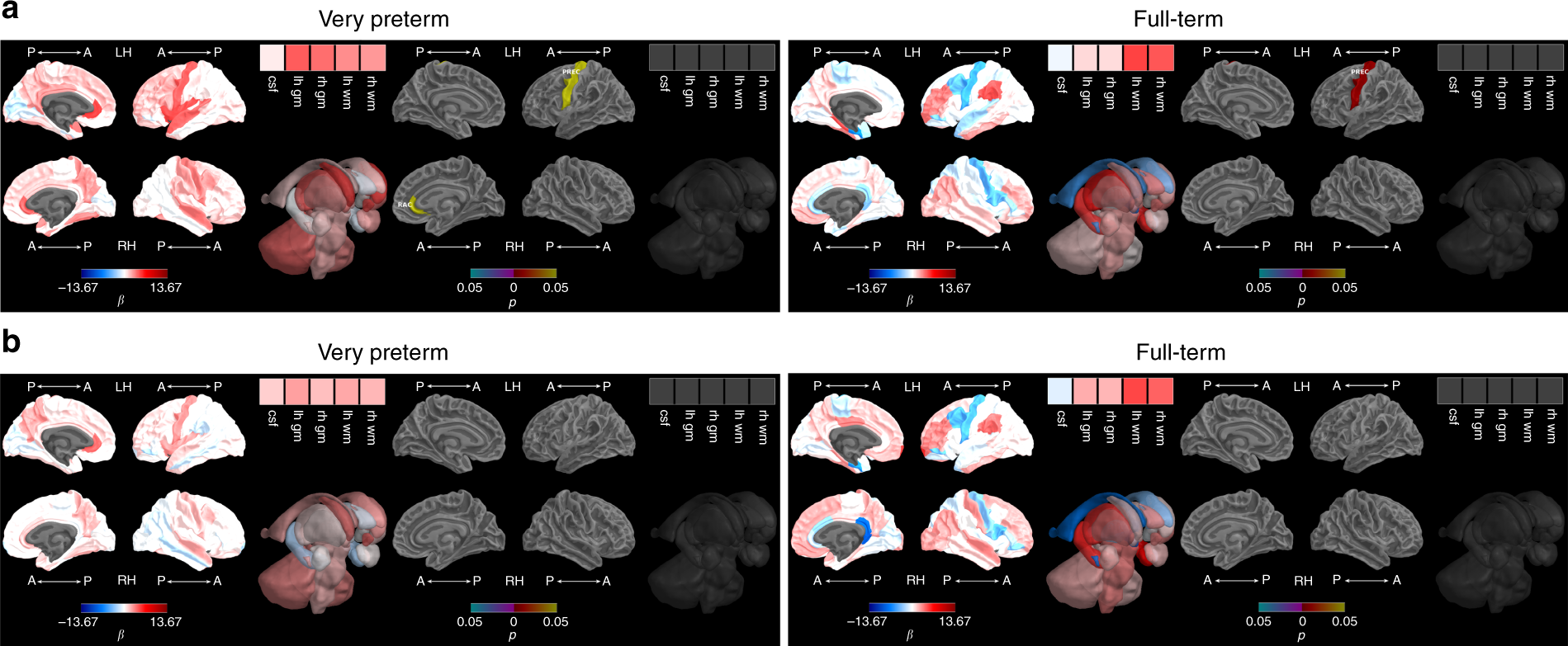 Fig. 4: Intelligence and brain growth from term-equivalent to 7 years.
