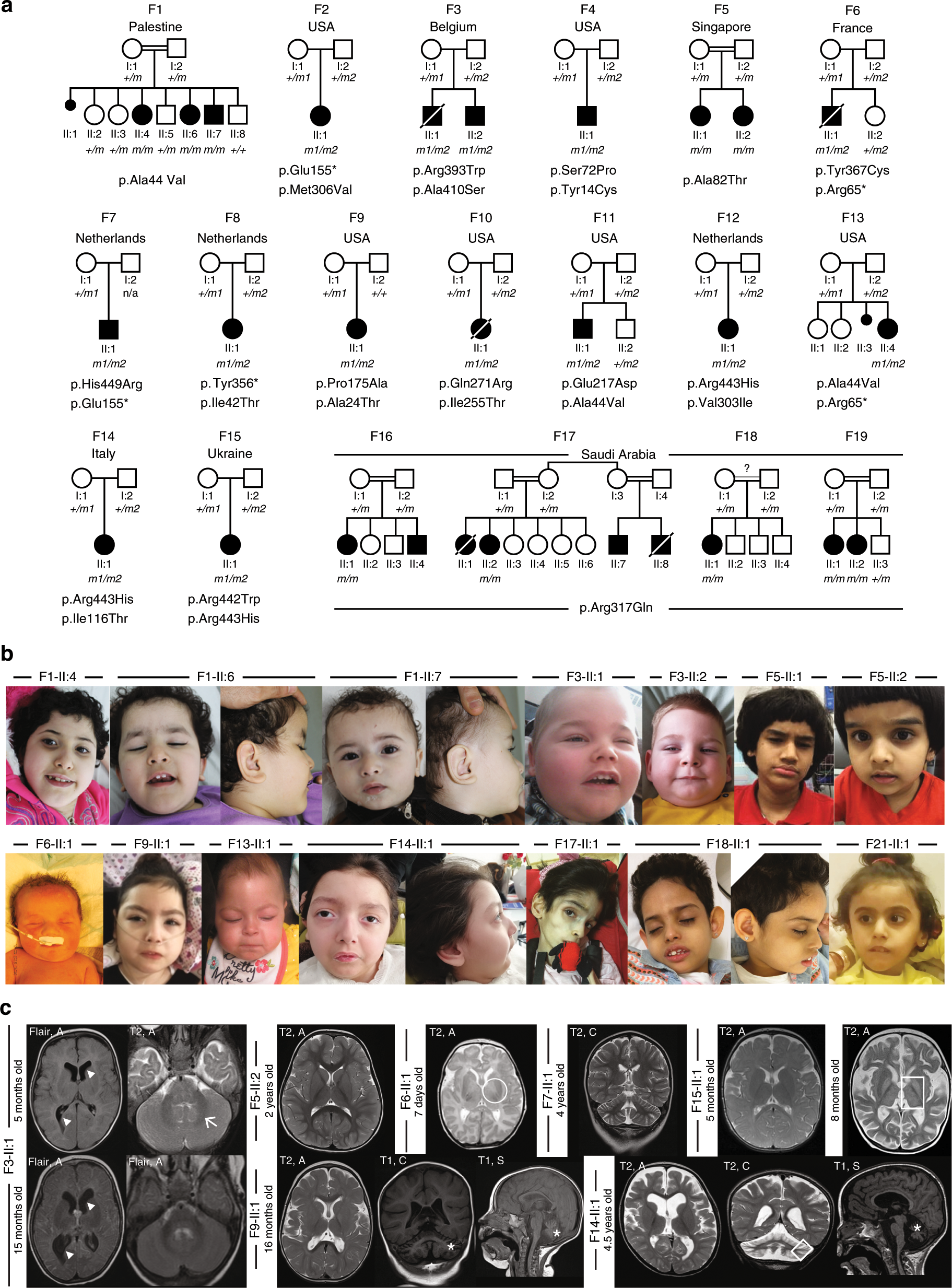 Loss Of Function Mutations In Udp Glucose 6 Dehydrogenase Cause Recessive Developmental Epileptic Encephalopathy Nature Communications Loss Of Function Mutations In Udp Glucose 6 Dehydrogenase Cause Recessive Developmental Epileptic Encephalopathy Nature Communications