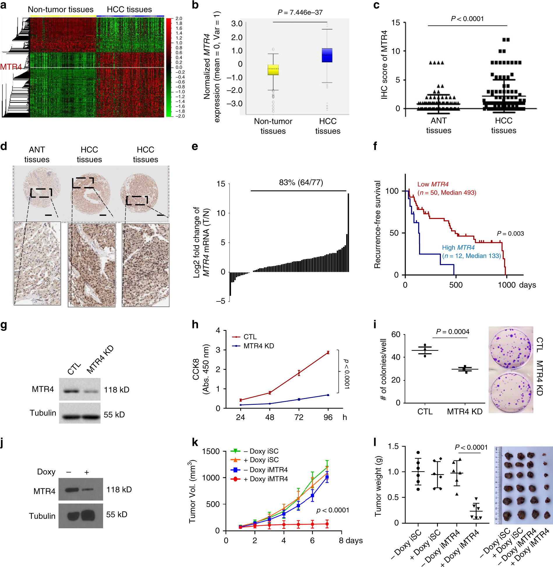 Fig. 1: MTR4 is required for the tumorigenesis of HCC cells.