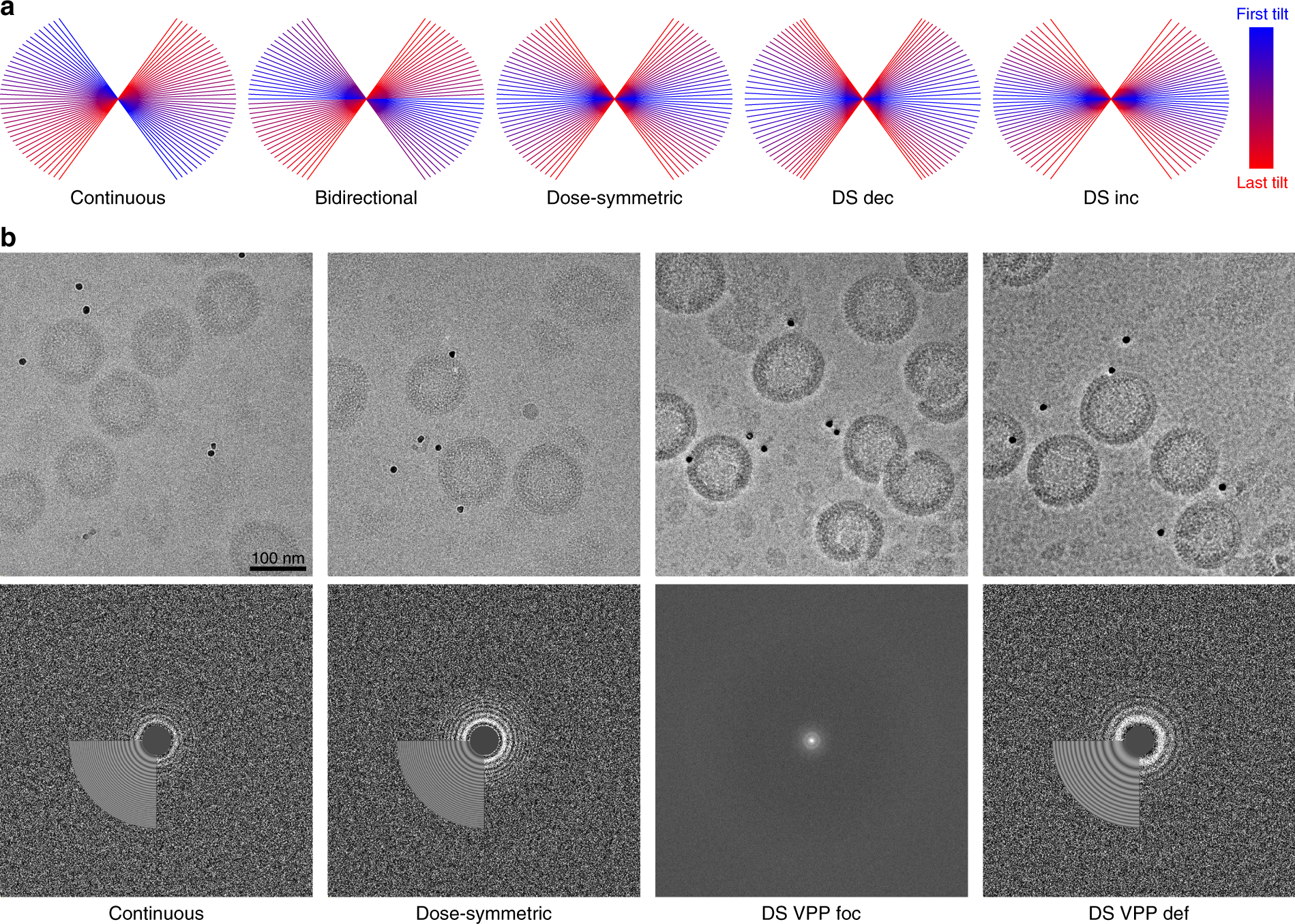 In situ cryo-electron tomography reveals the asymmetric