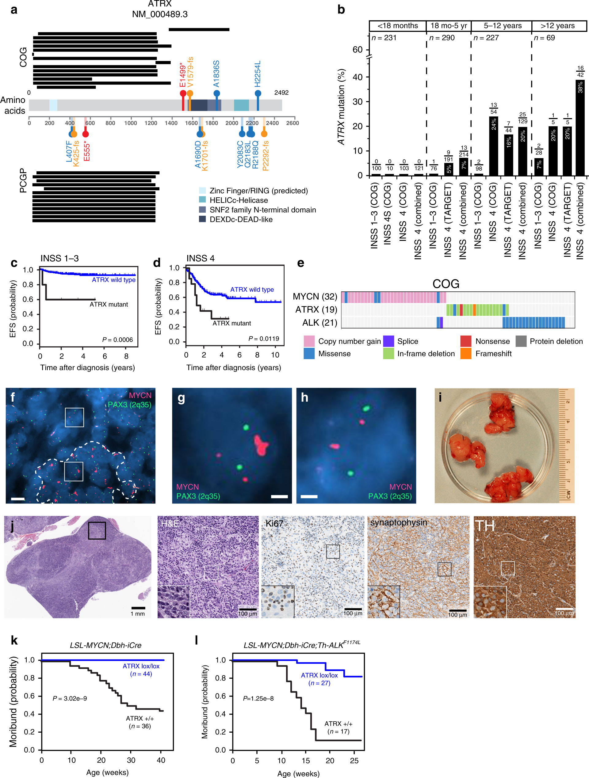 MYCN amplification and ATRX mutations are incompatible in neuroblastoma Nature Communications image