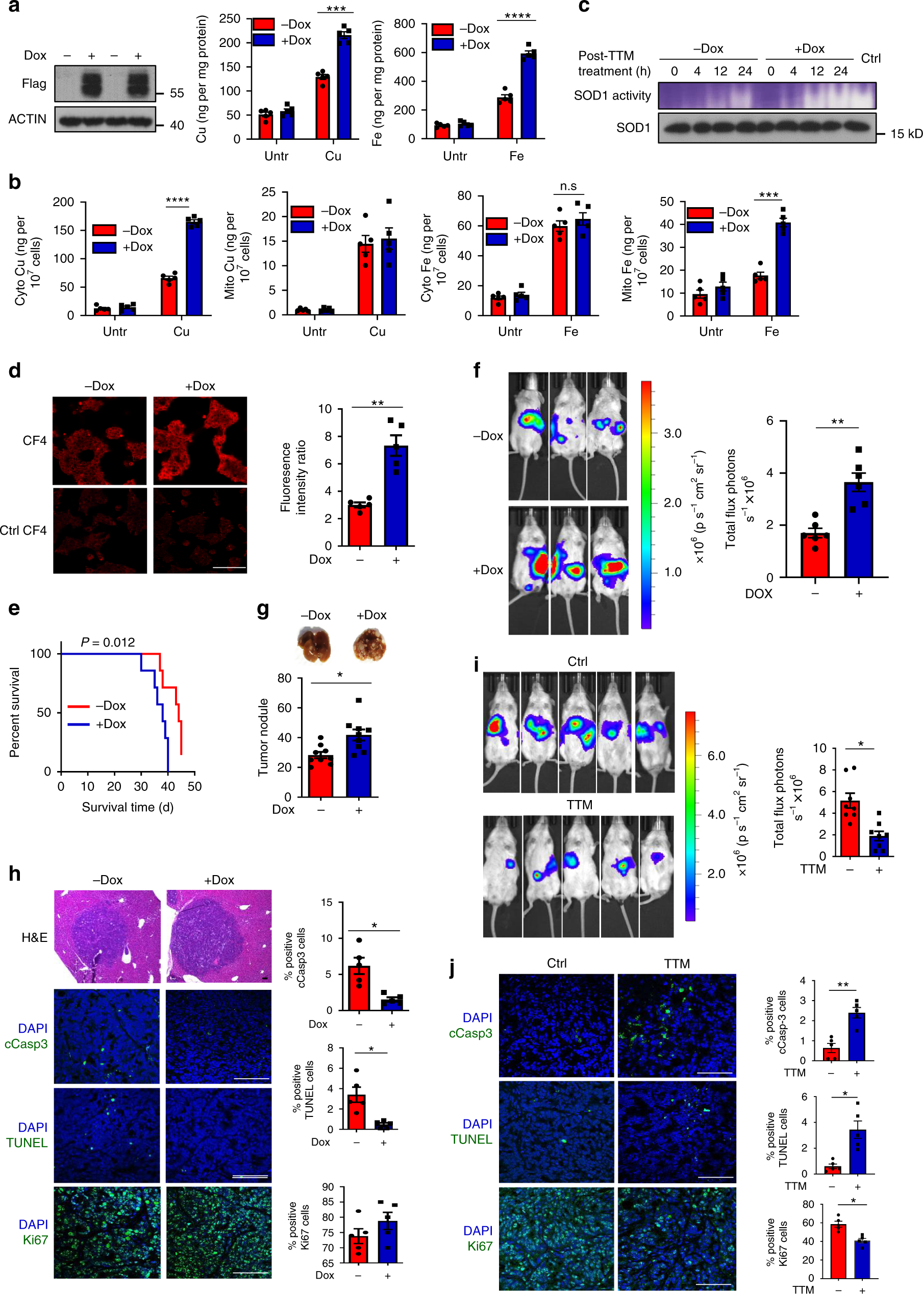 Fig. 2: STEAP4-mediated copper uptake leads to tumor metastasis.
