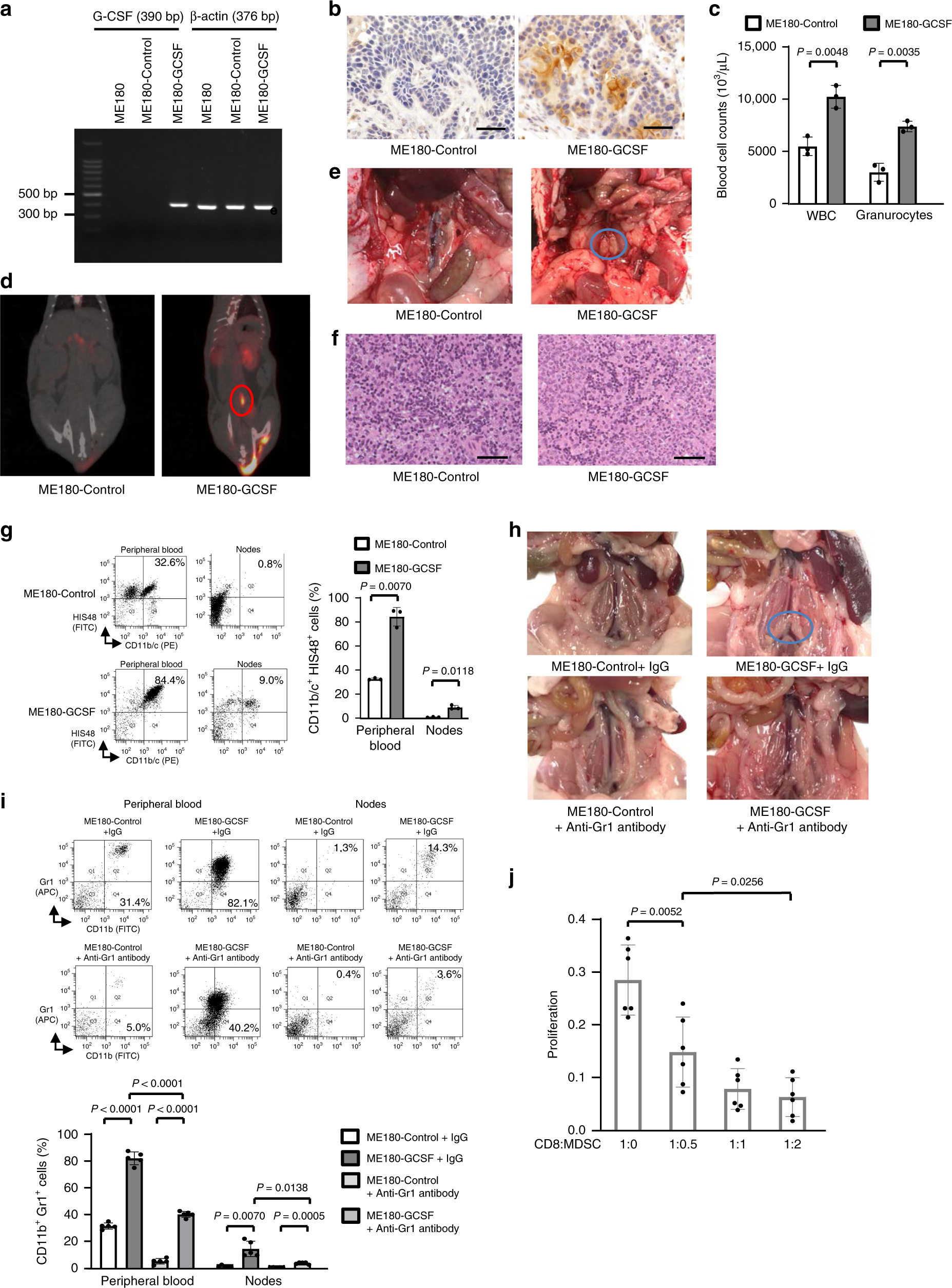 Fig. 3: Effects of tumor-derived G-CSF on the PALN and 18F-FDG-PET/CT in animal models of cervical cancer.