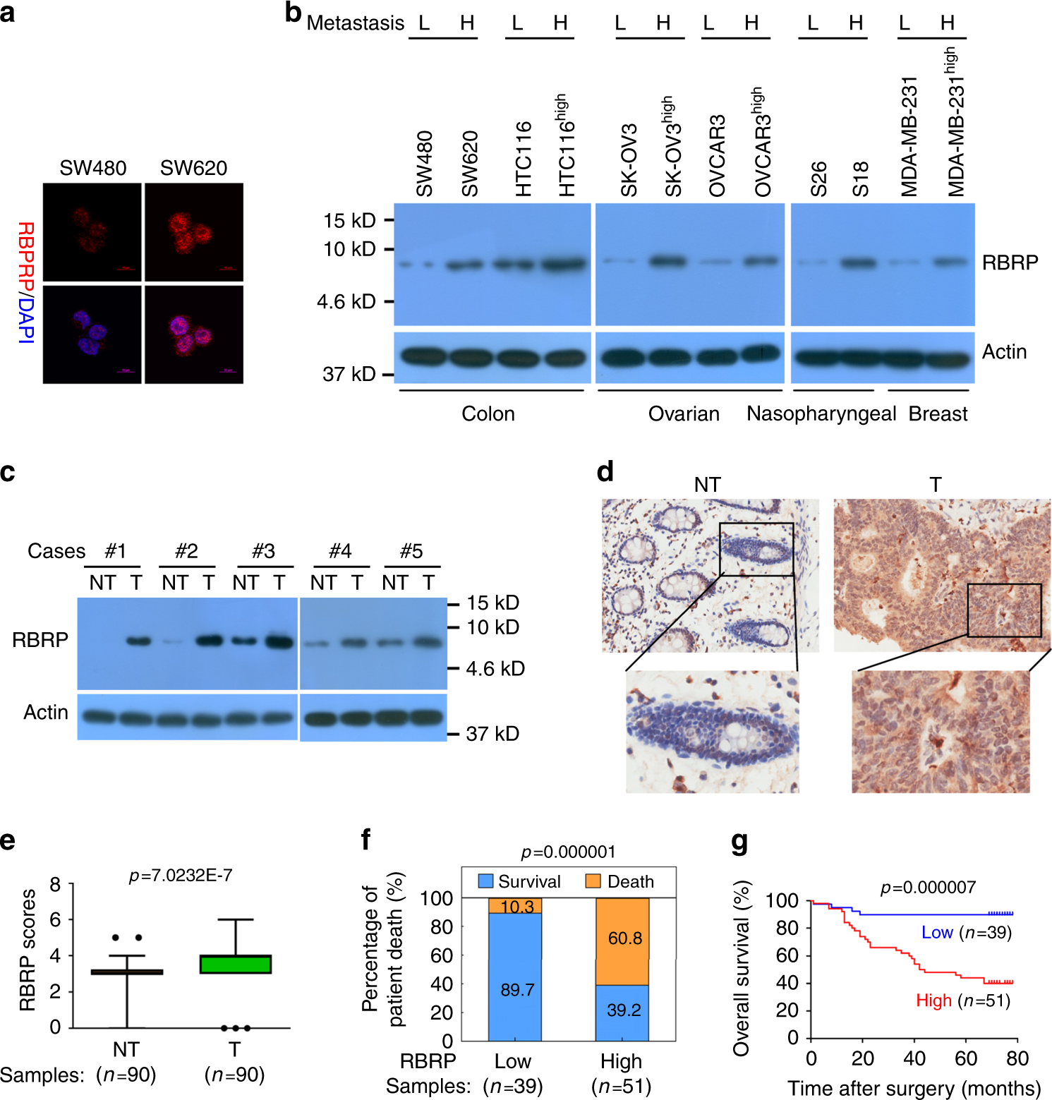 Fig. 2: The LINC00266-1-encoded RBRP peptide is endogenously and naturally produced, and its upregulation is associated with a poor prognosis of patients with CRC.