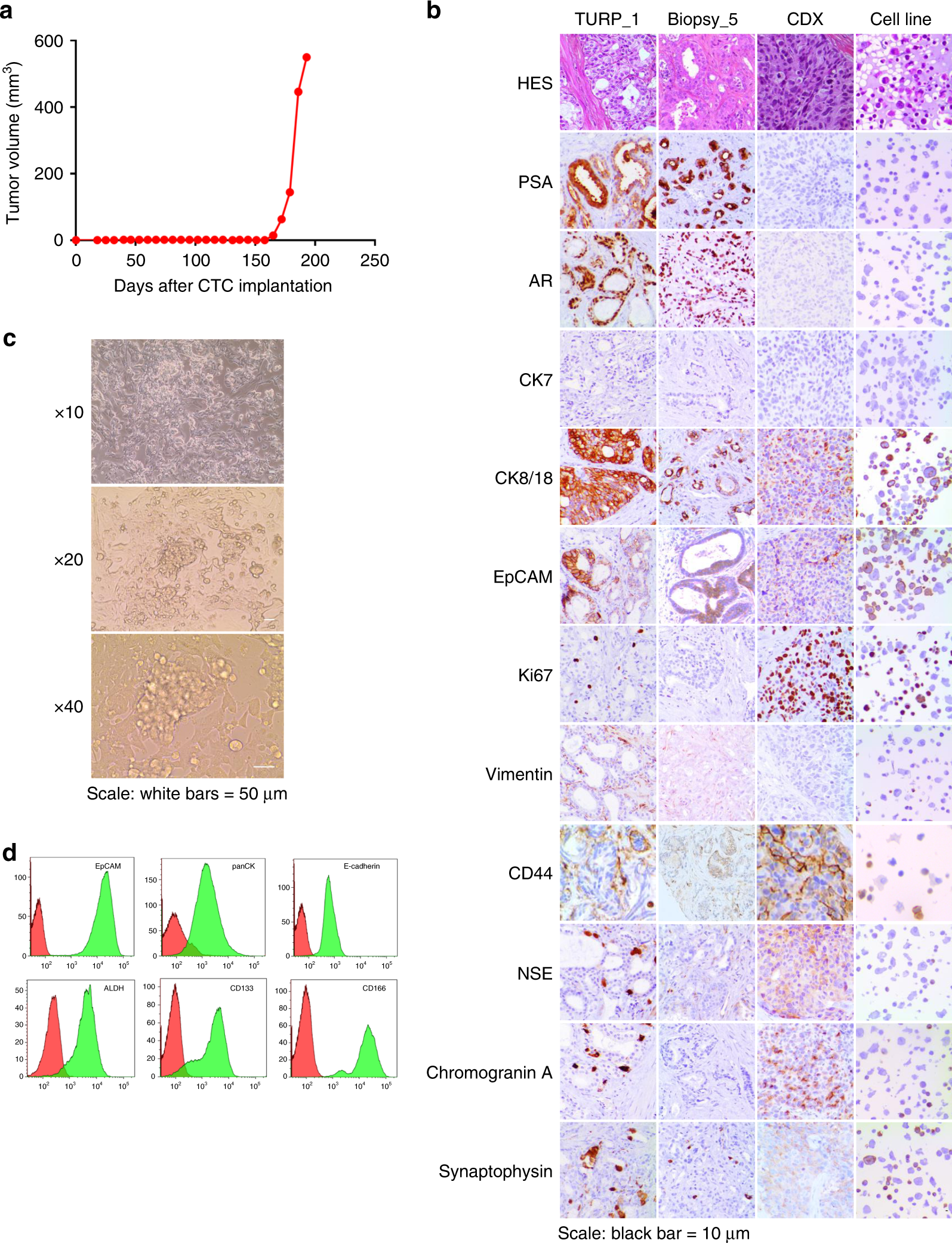 Genetic characterization of a unique neuroendocrine transdifferentiation  prostate circulating tumor cell-derived eXplant model | Nature  Communications
