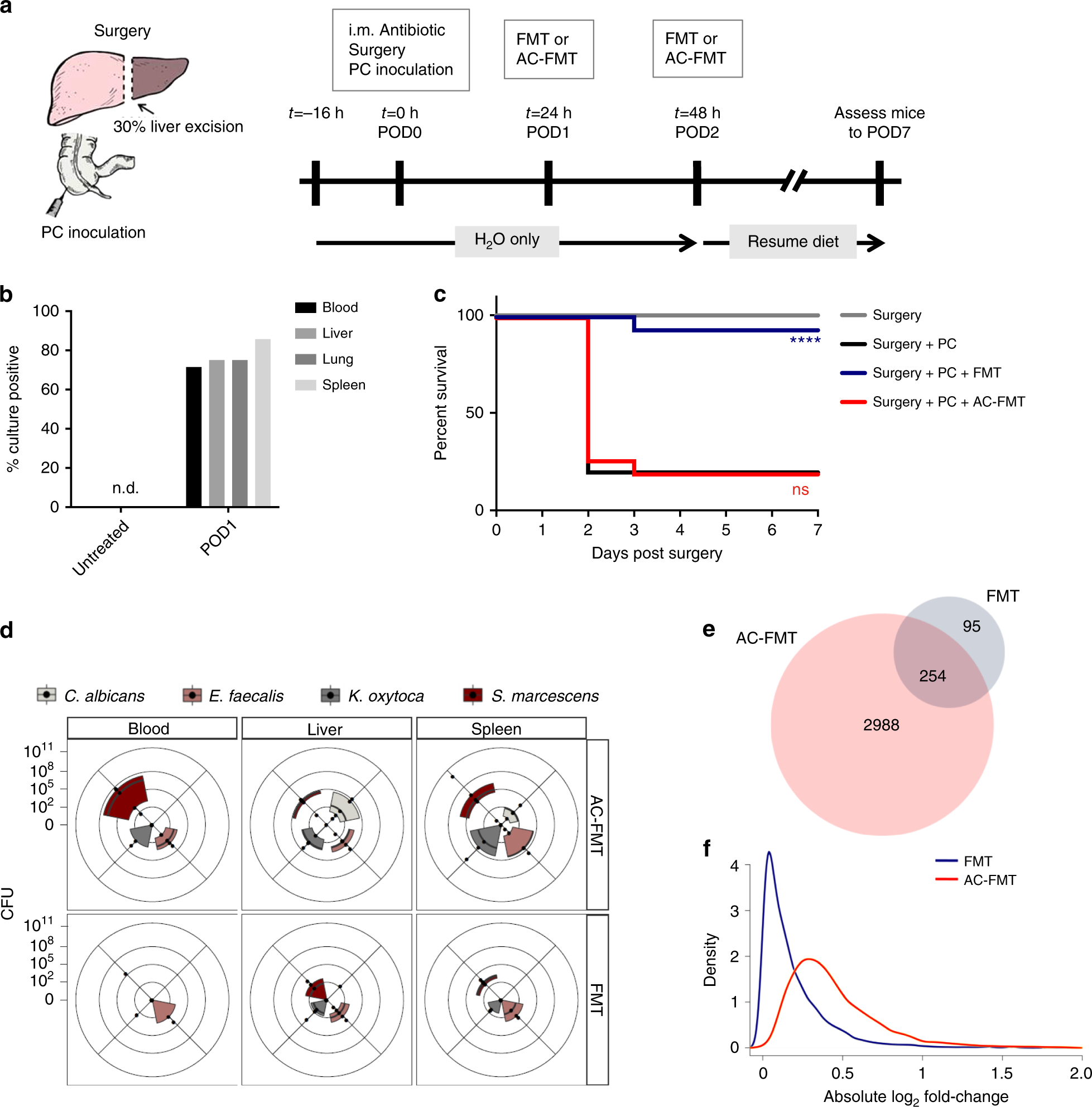 Q&A: DIY fecal microbiota transplantation a risky game of 'Russian roulette