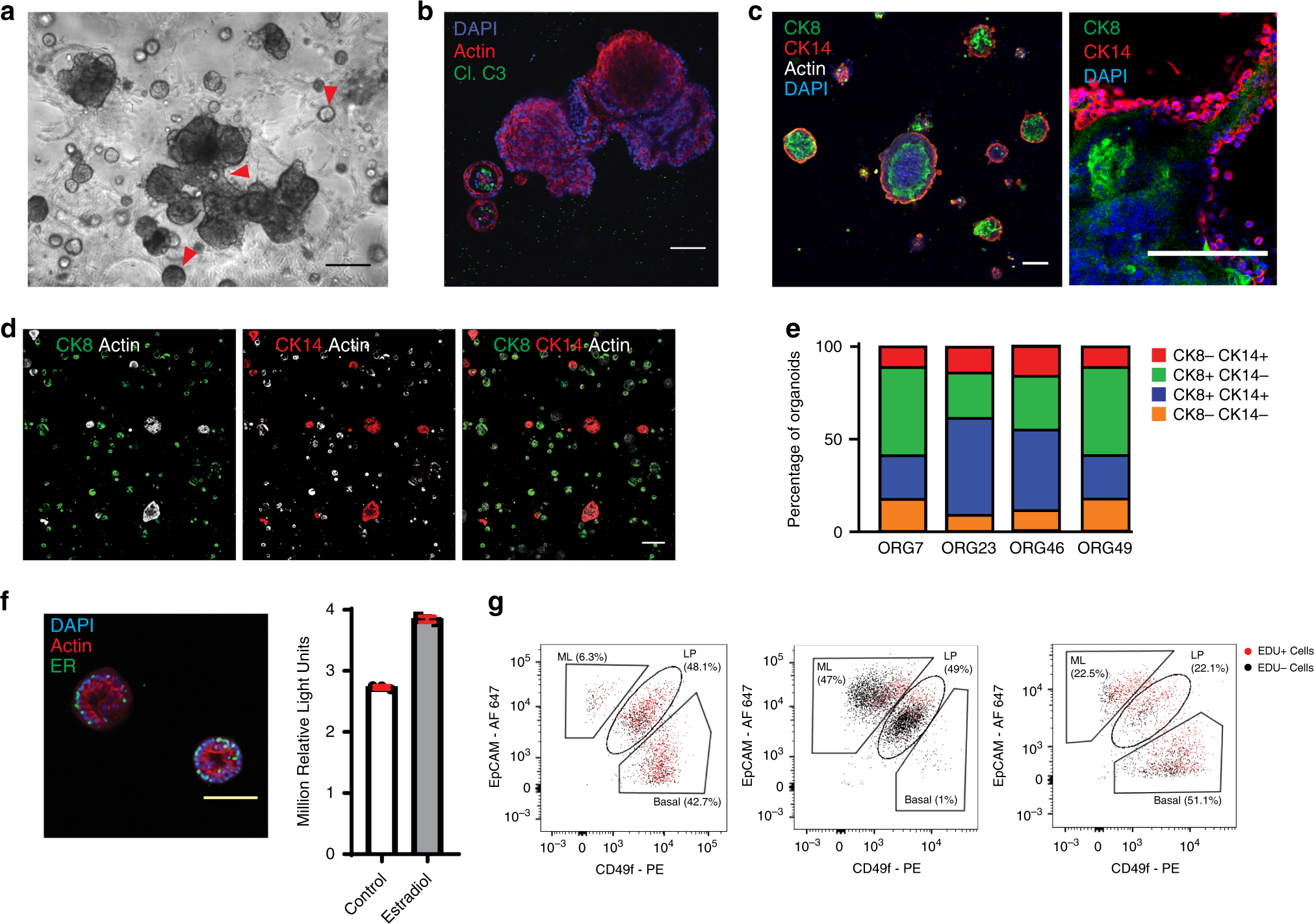 Organoid cultures from normal and cancer-prone human breast tissues  preserve complex epithelial lineages | Nature Communications