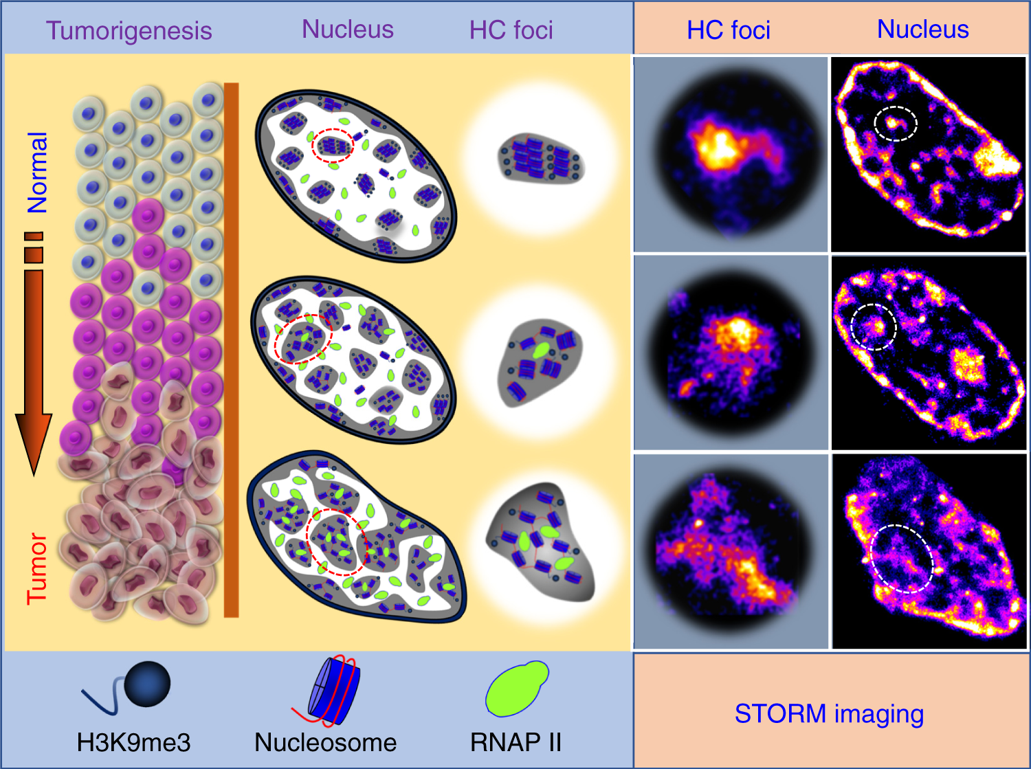 Fig. 8: Model to depict the molecular-scale heterochromatin structure in carcinogenesis.