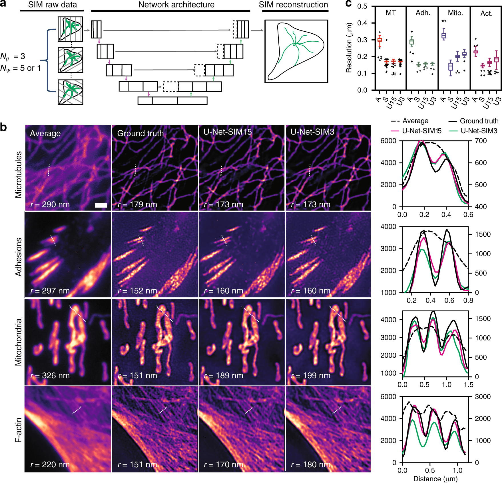 Deep learning enables structured illumination microscopy with low light  levels and enhanced speed | Nature Communications