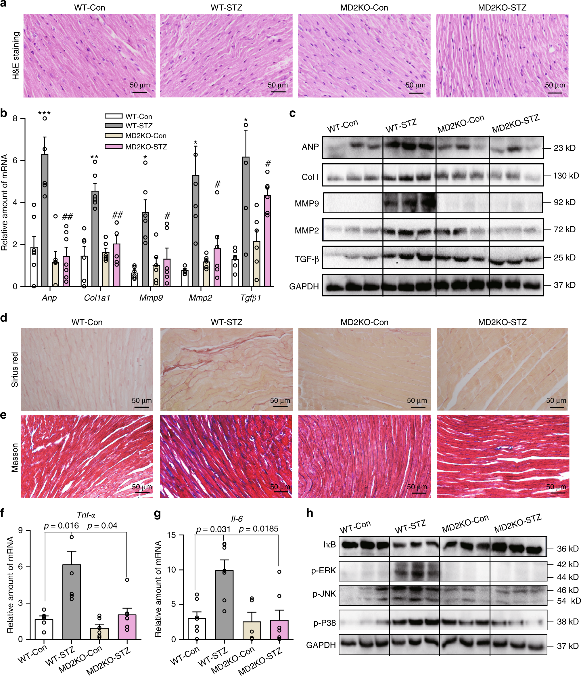 Fig. 2: MD2 deficiency prevents diabetes-induced cardiac injury.