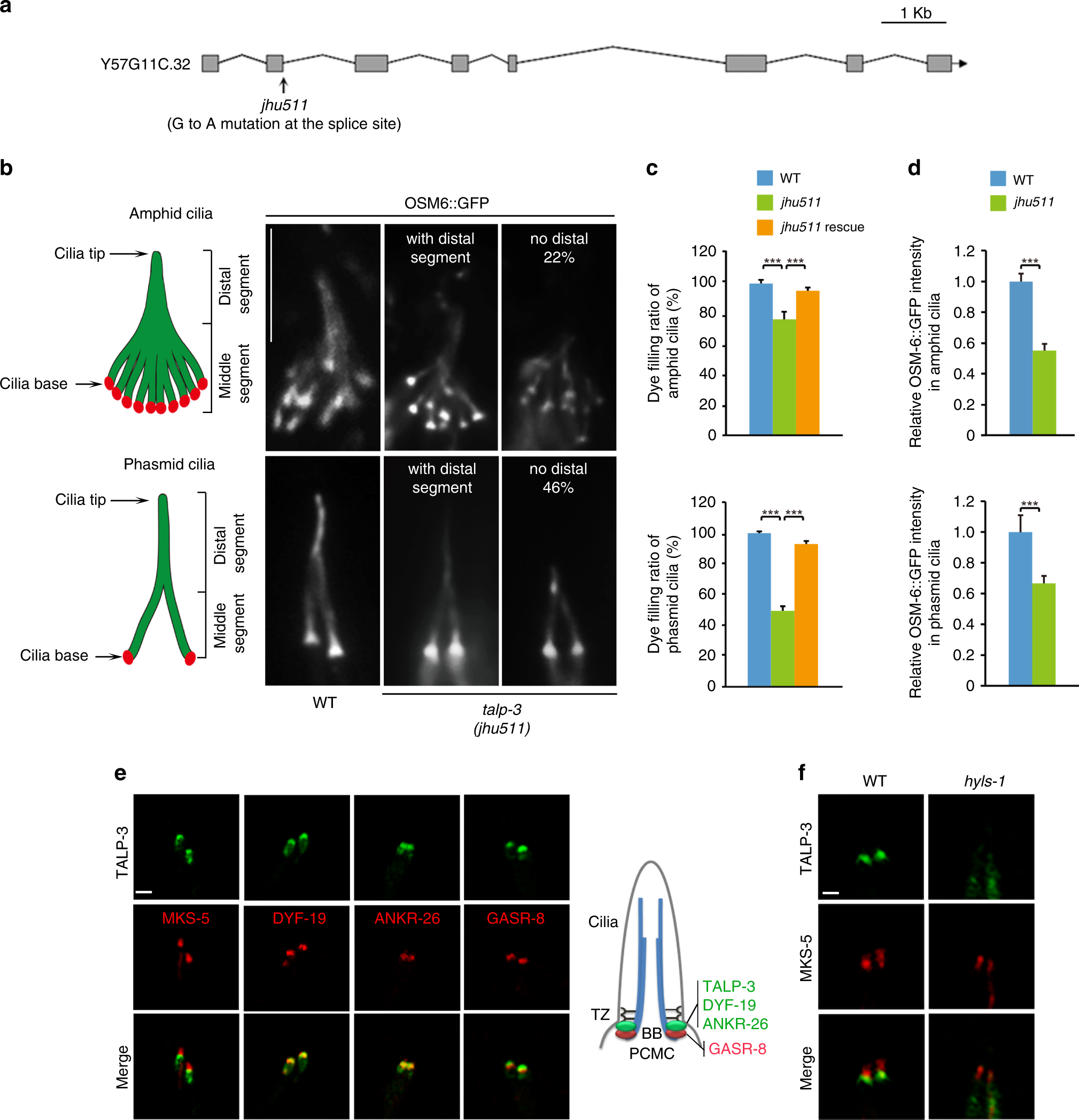 TALPID3 and ANKRD26 selectively orchestrate FBF1 localization and cilia  gating | Nature Communications