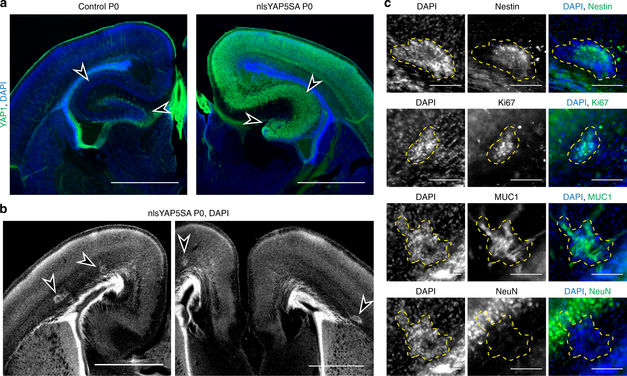 Fig. 2: Uncontrolled YAP1 in NEX-Cre-expressing cells is sufficient for tumour formation at the expense of hippocampal differentiation.