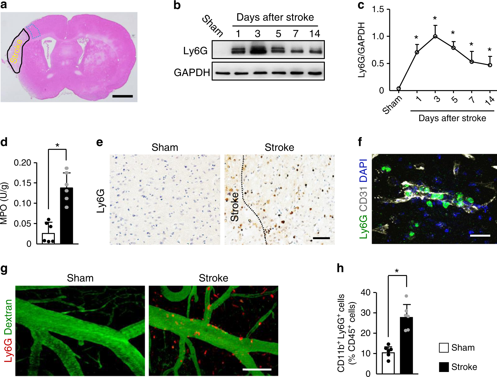 Stroke subtype-dependent synapse elimination by reactive gliosis in mice